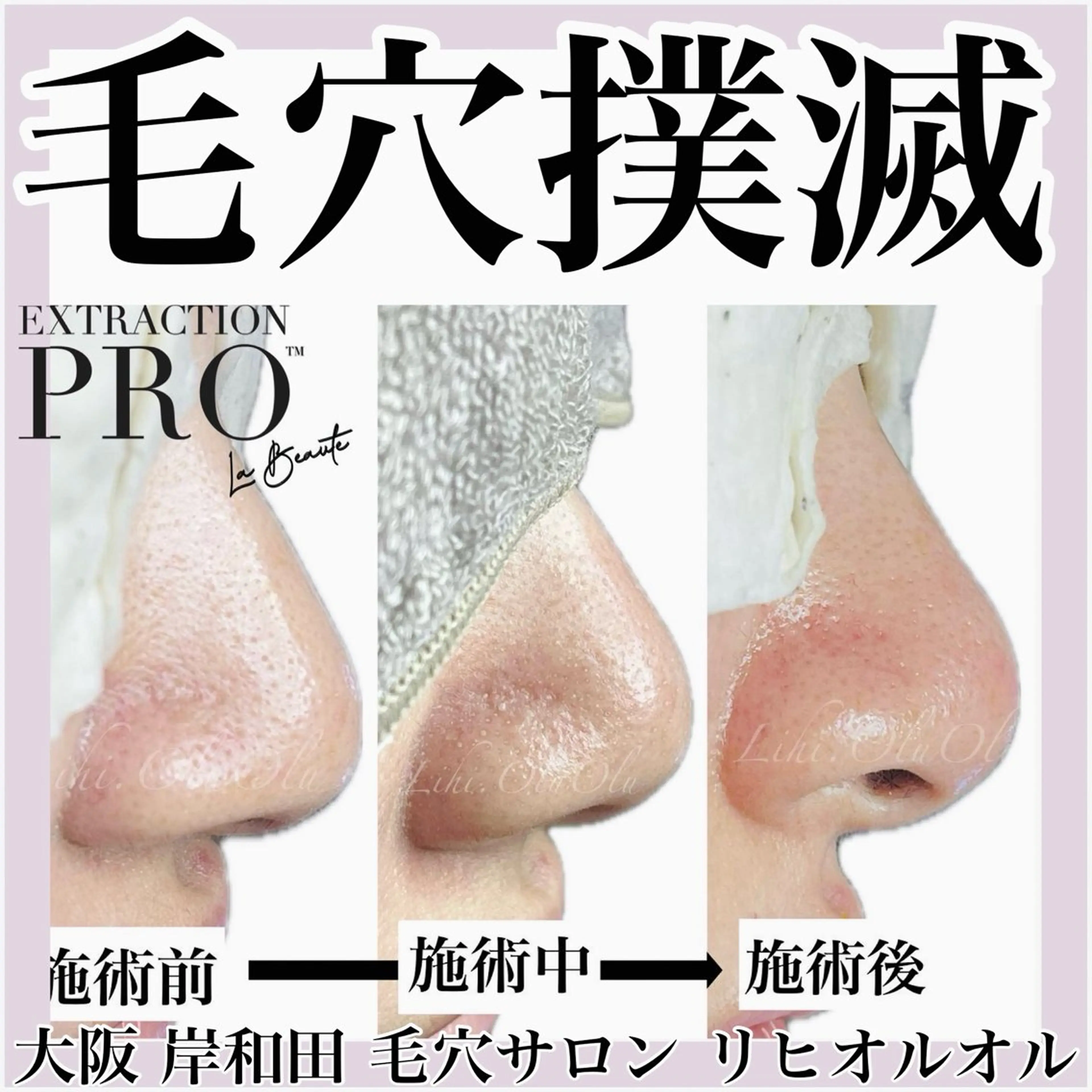 毛穴汚れ改善専門店/ 岸和田/リヒオルオルのエステ・リラクイメージ