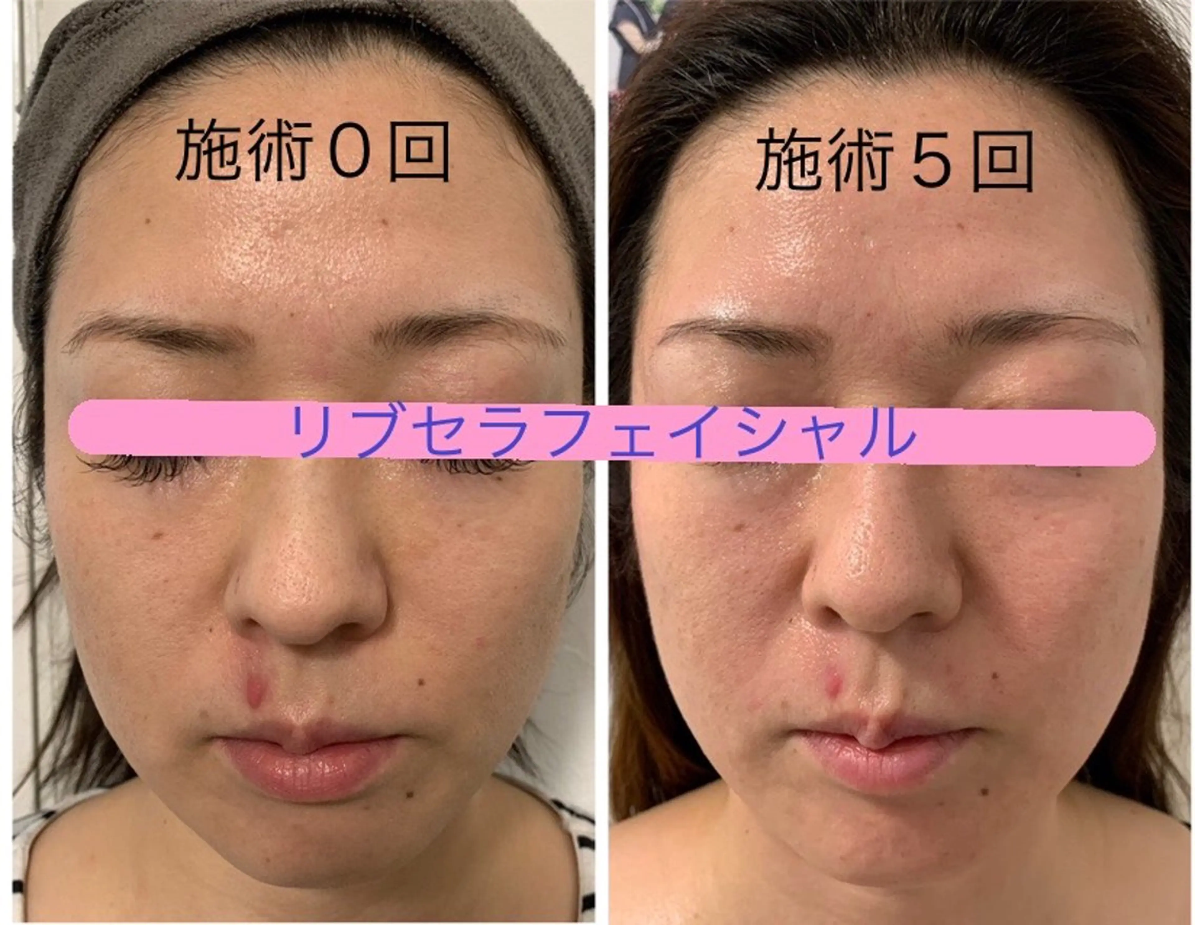 エステ Private Salon Prunelle所属・プライベートサロン プリュネルのエステ・リラクイメージ