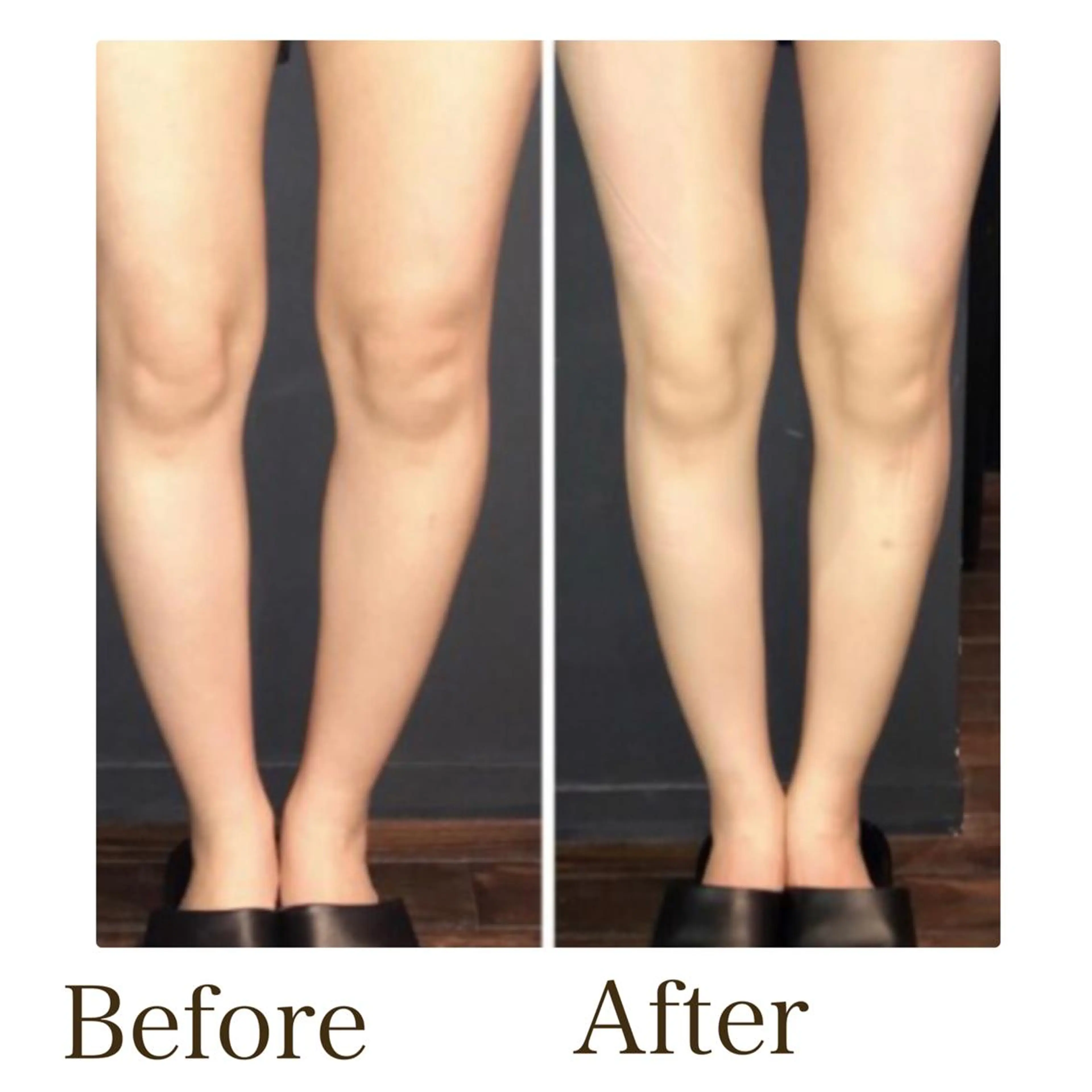 MiMiy 銀座店のエステ・リラクイメージ