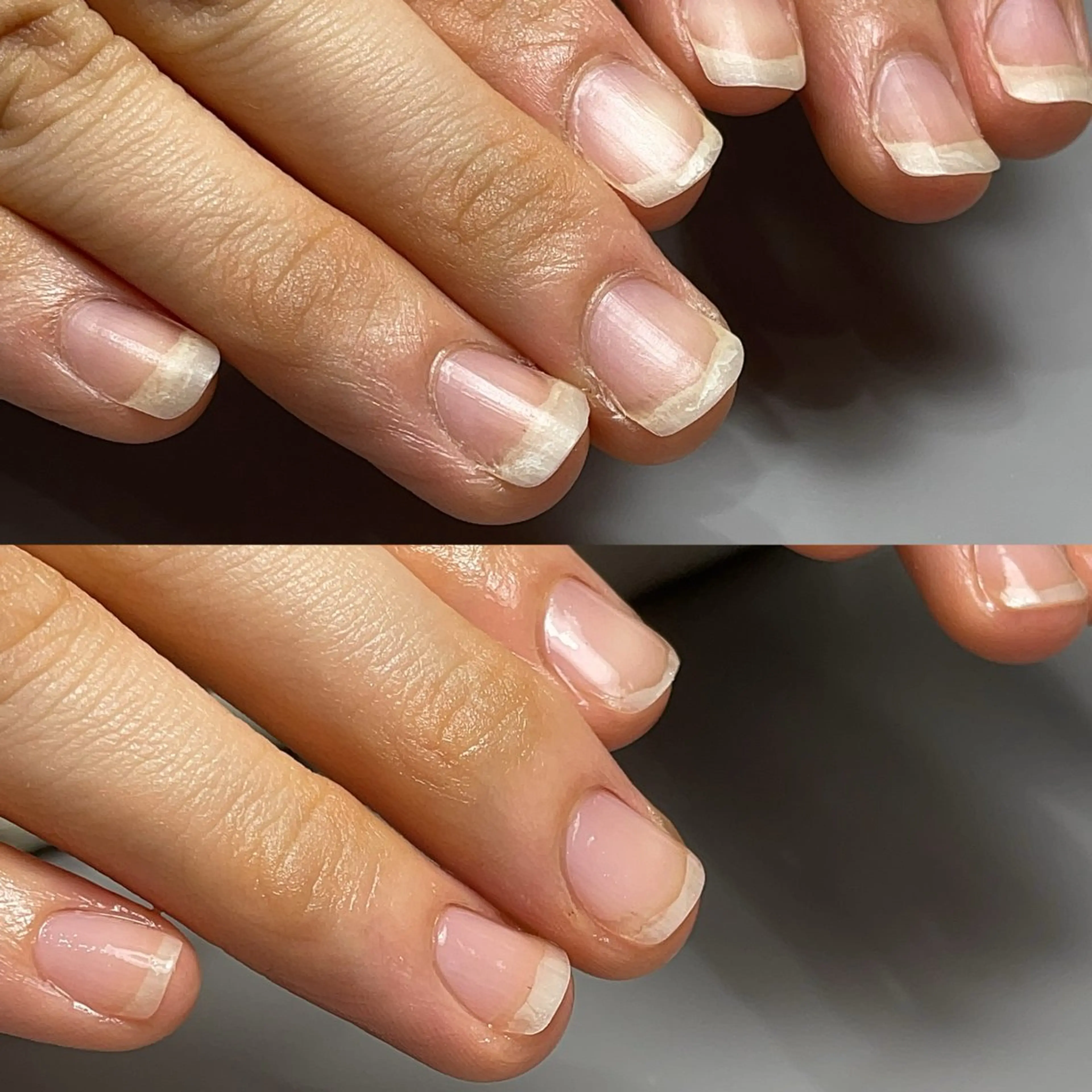 ネイル Aim* 深爪・自爪育成専門店のネイルデザイン