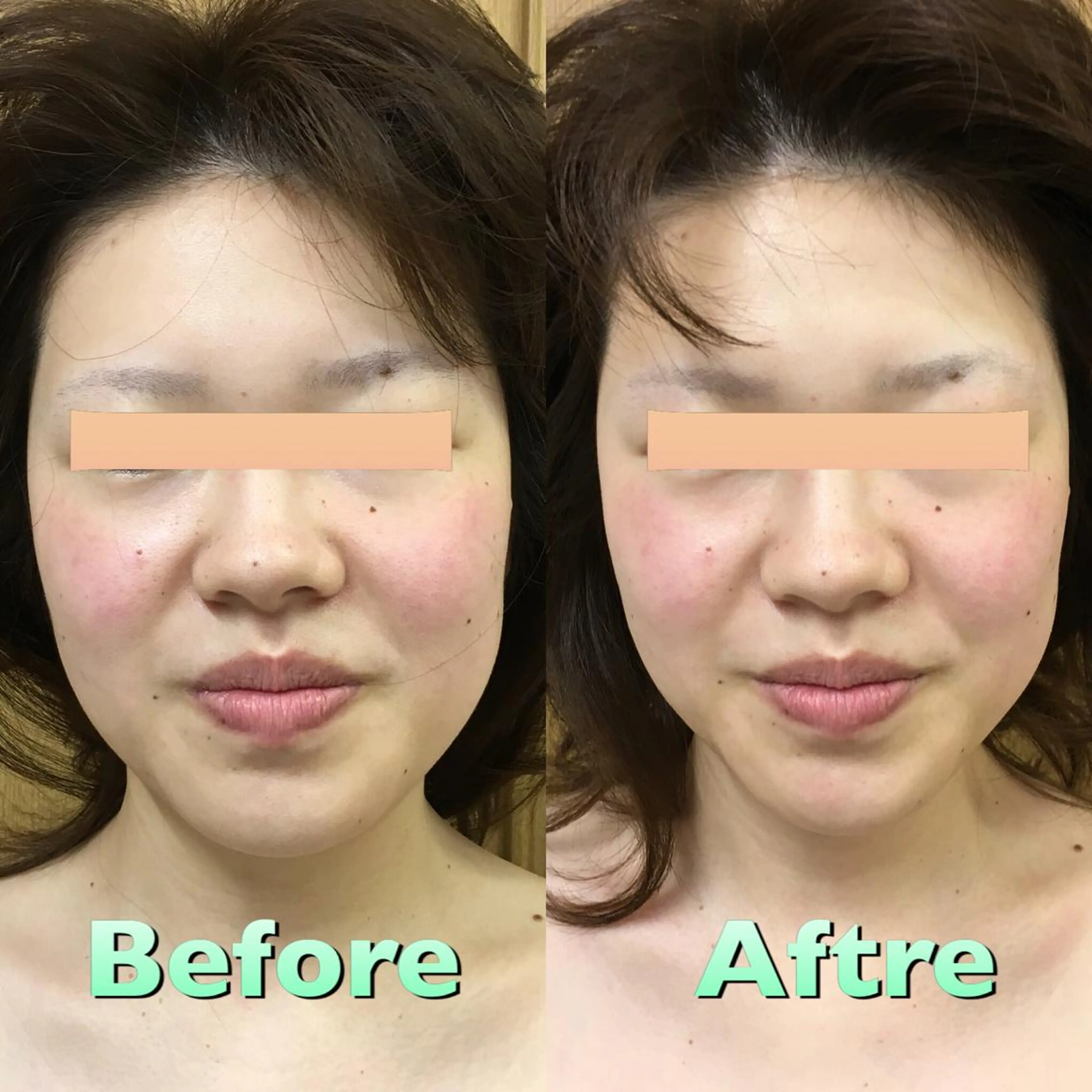 小顔筋膜矯正サロン桜Biscuit~サクラビスケット~所属・小顔/肩こり/脱毛 桜Bisucuitのエステ・リラクイメージ