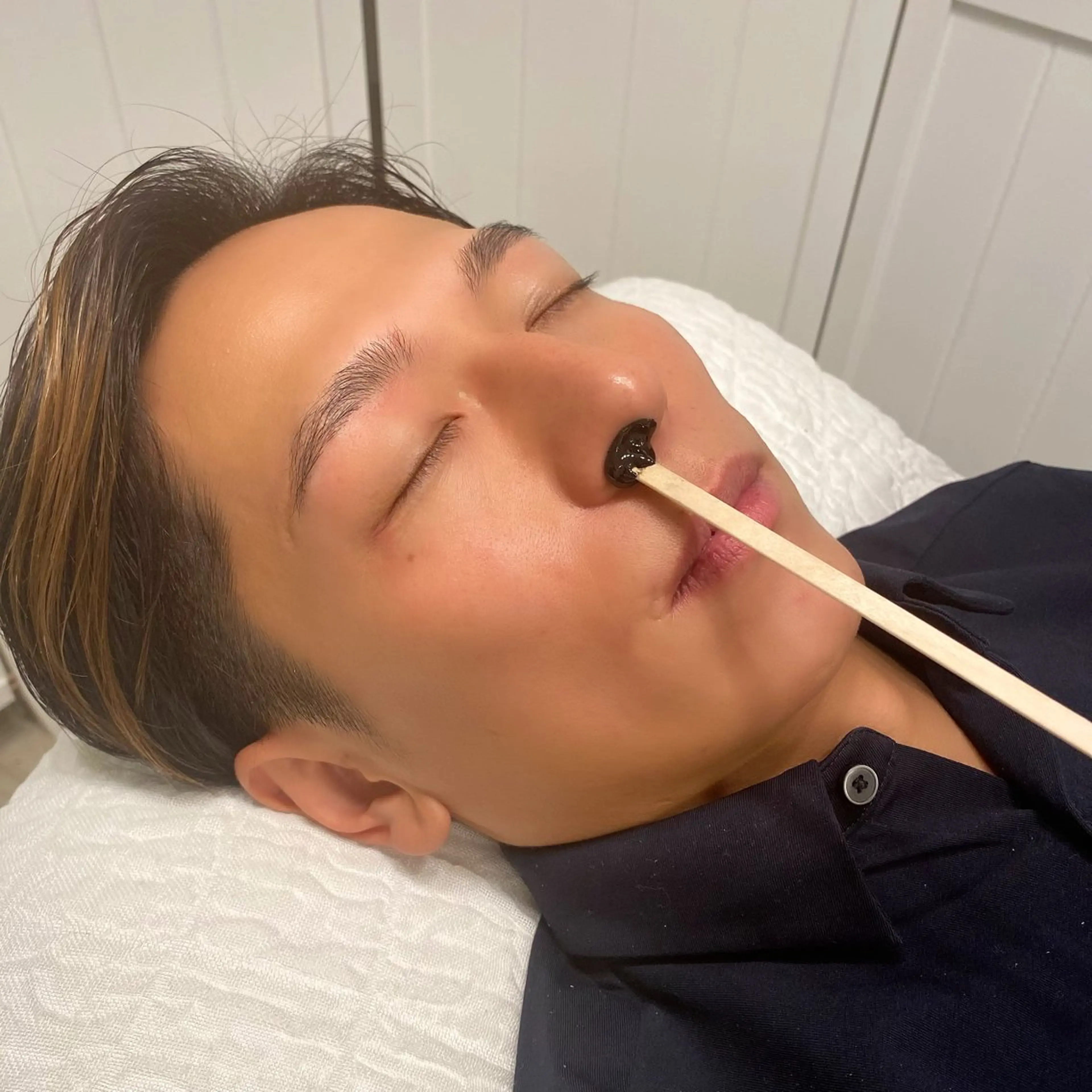 鼻毛脱毛の写真