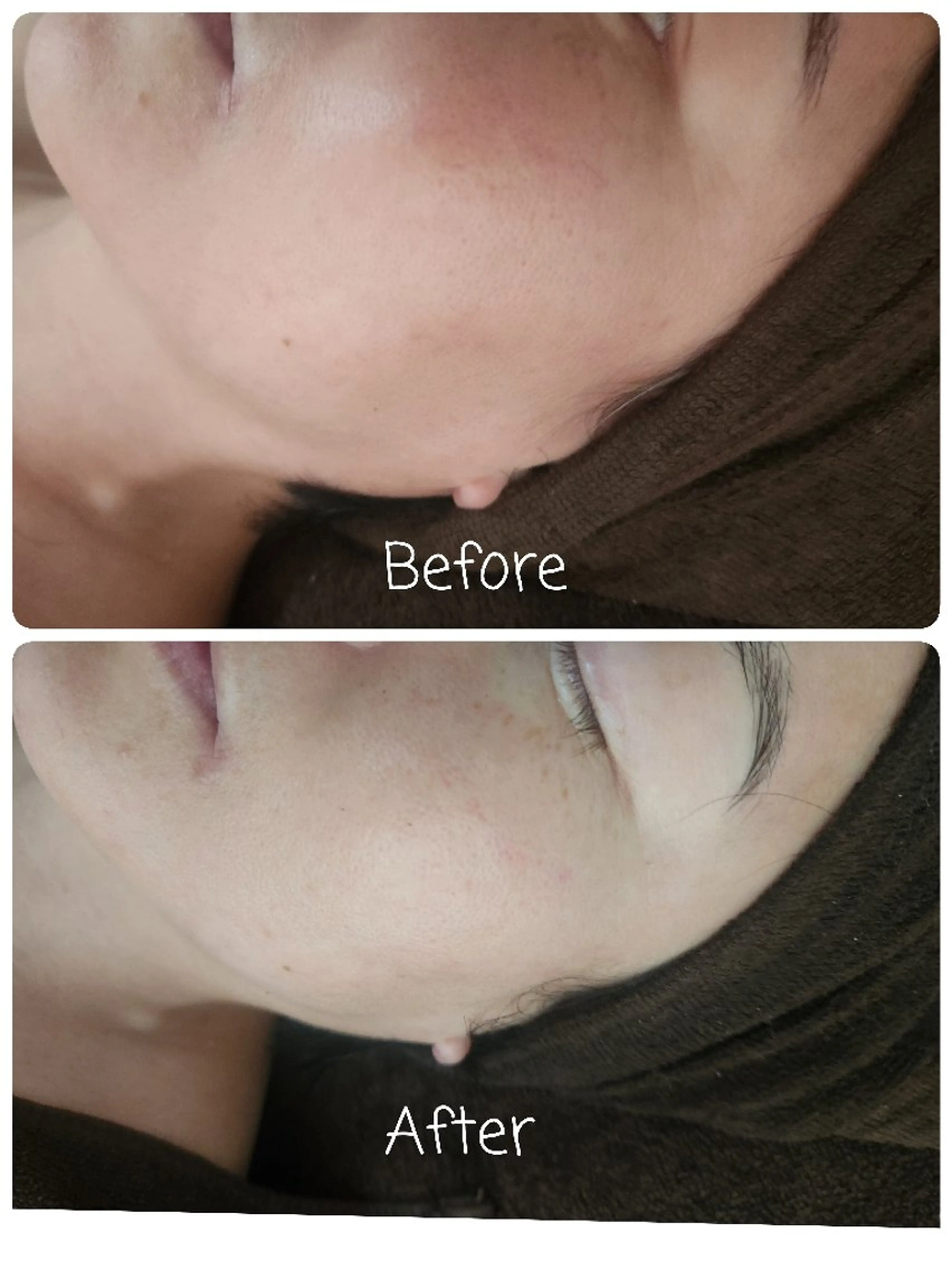 Perte所属・ . Atsumiのエステ・リラクイメージ