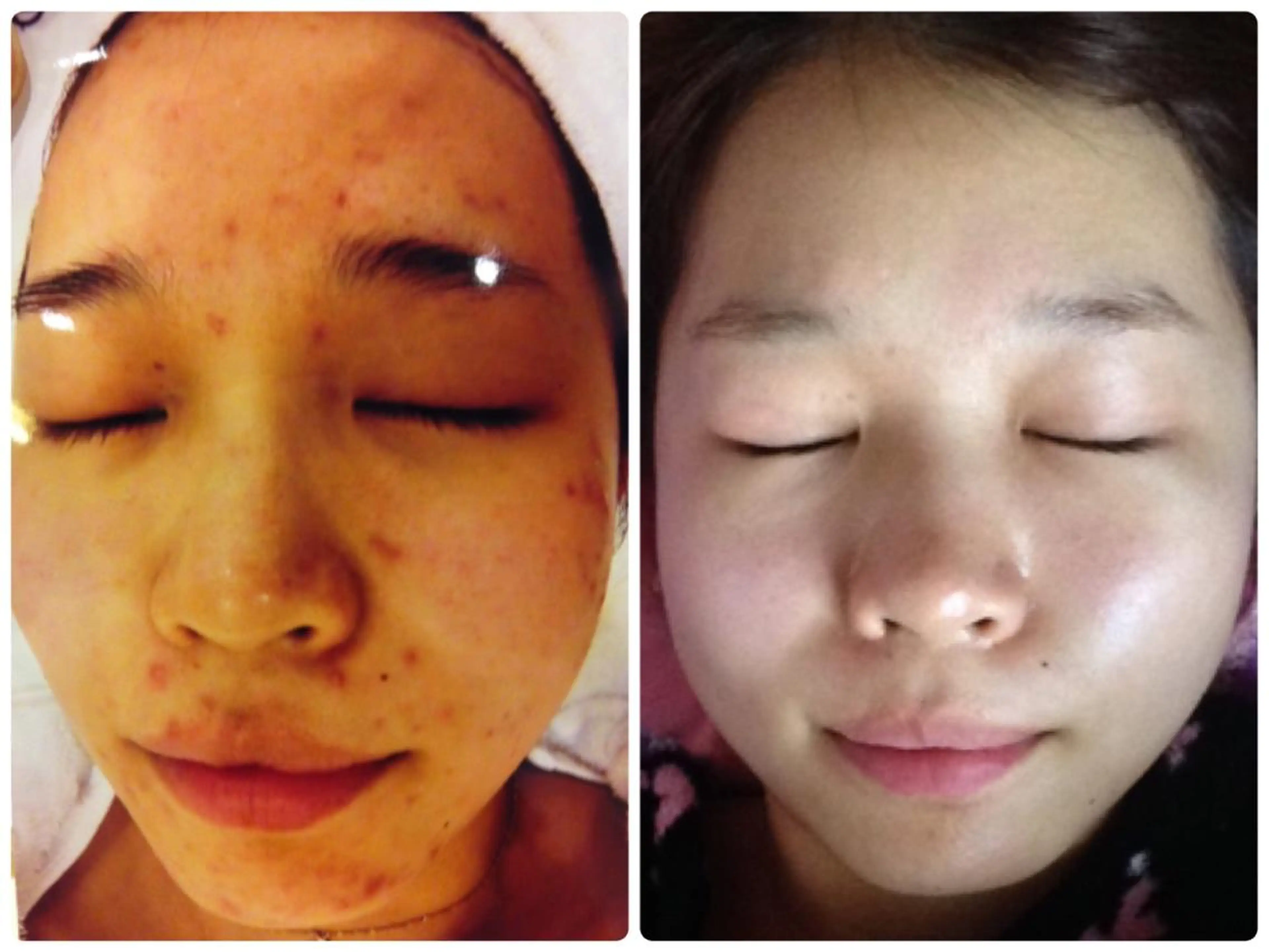 都度払い肌質改善 &脱毛Blancheのエステ・リラクイメージ