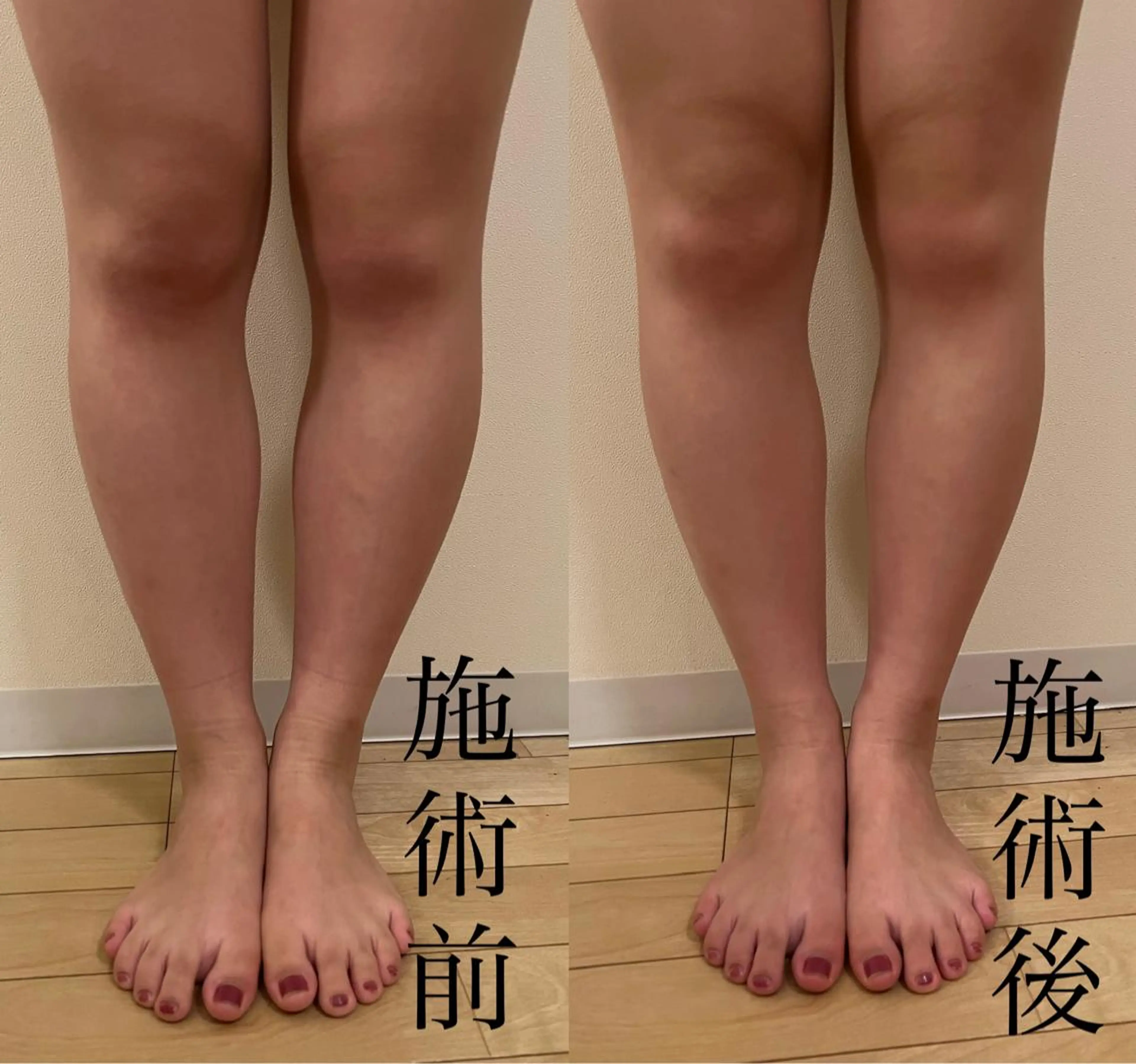 WOM SALON所属・MIKU【美容整形ダ ウンタイムケア銀座】のエステ・リラクイメージ