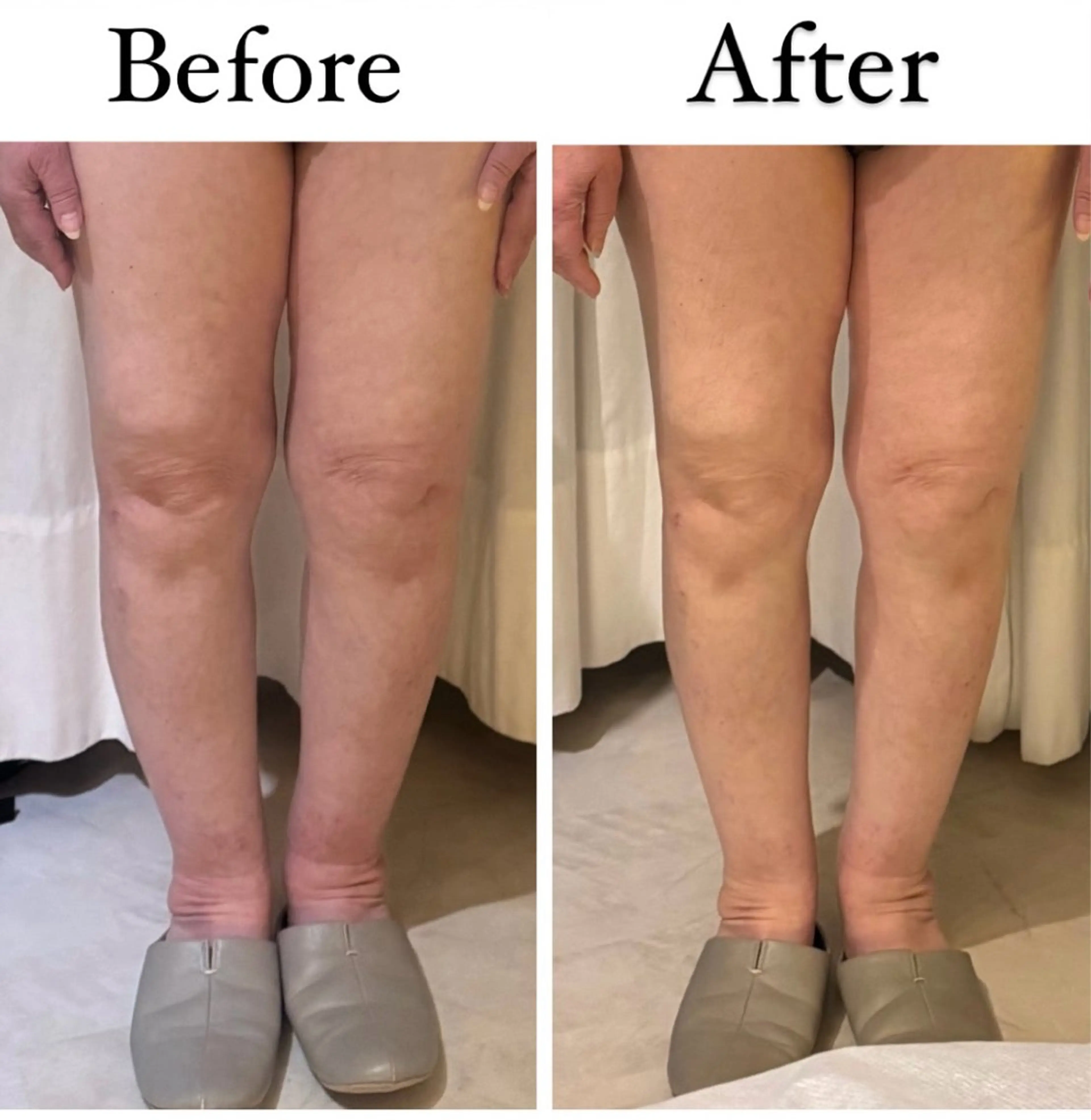 エステ Crystallo Sana N所属・痩身・リンパ 佐久間 自由が丘・奥沢のエステ・リラクイメージ