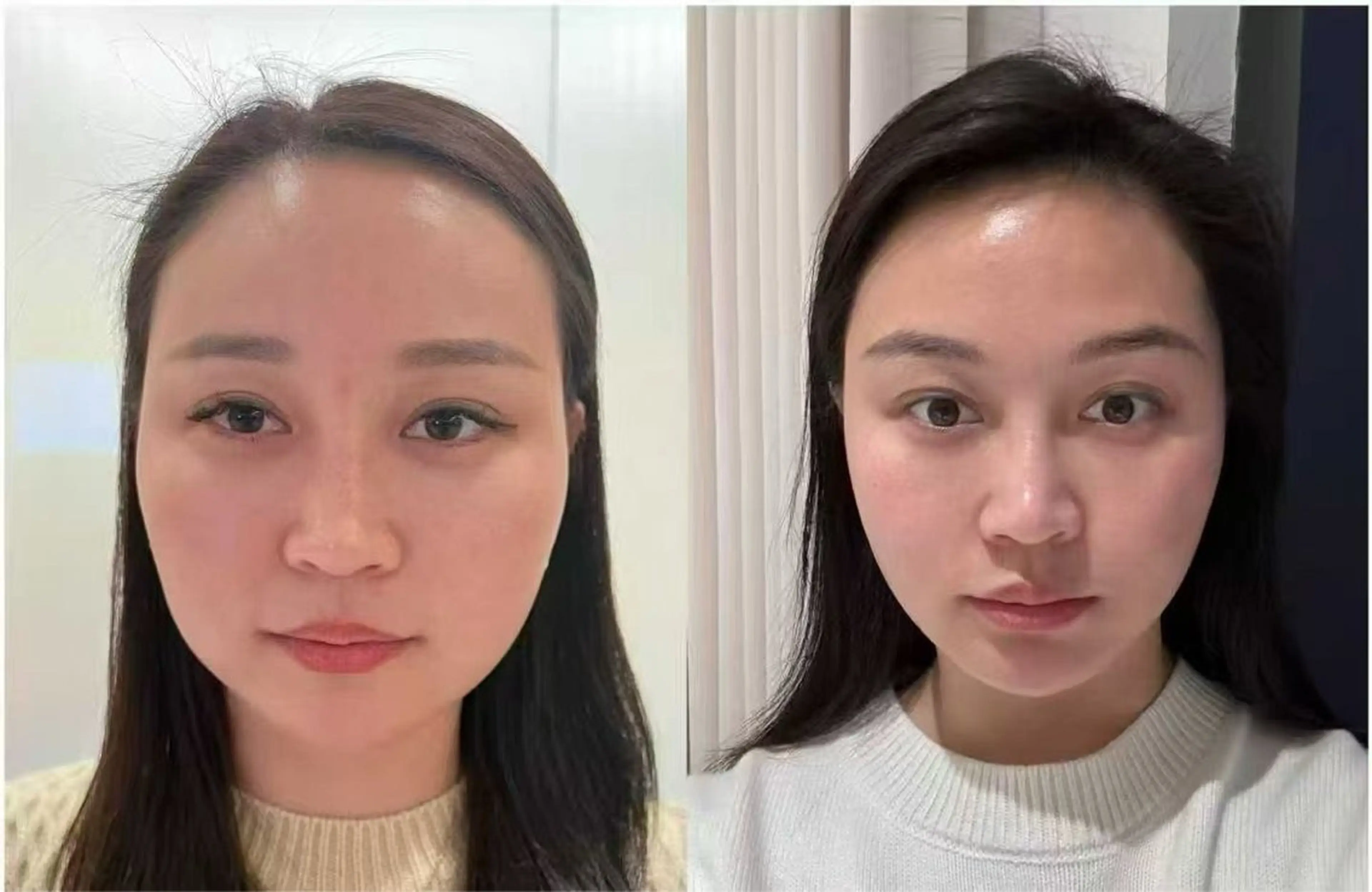 マツエク・マツパ エステ リラク 愛維美水光美肌専門店所属・愛維美水光美肌専門店 メンズレディースokのエステ・リラクイメージ