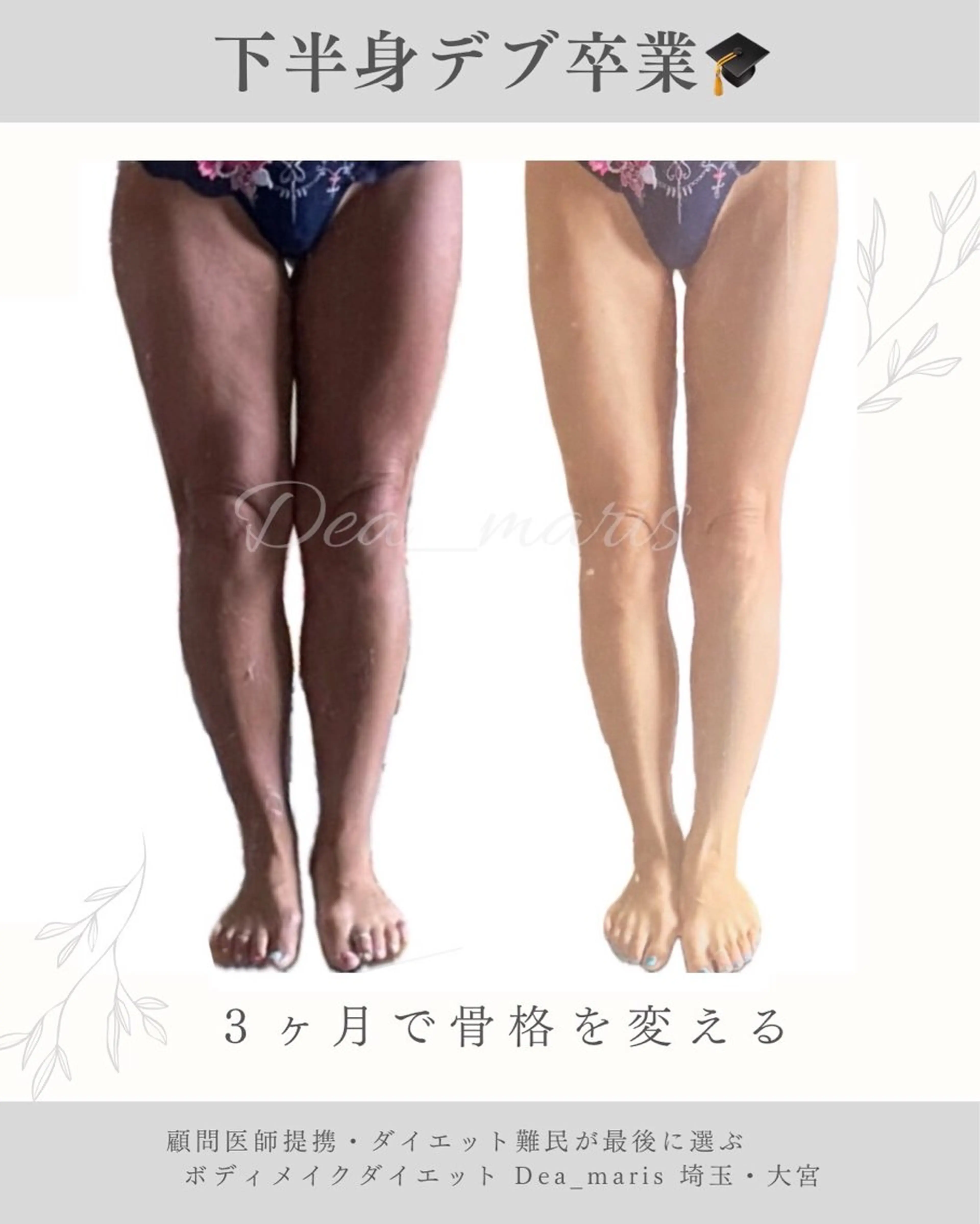 private salon  Dea_maris シュガーリング＆パーソナルボディケア所属・シミ改善・韓国肌管理 ボディメイク痩身のその他イメージ