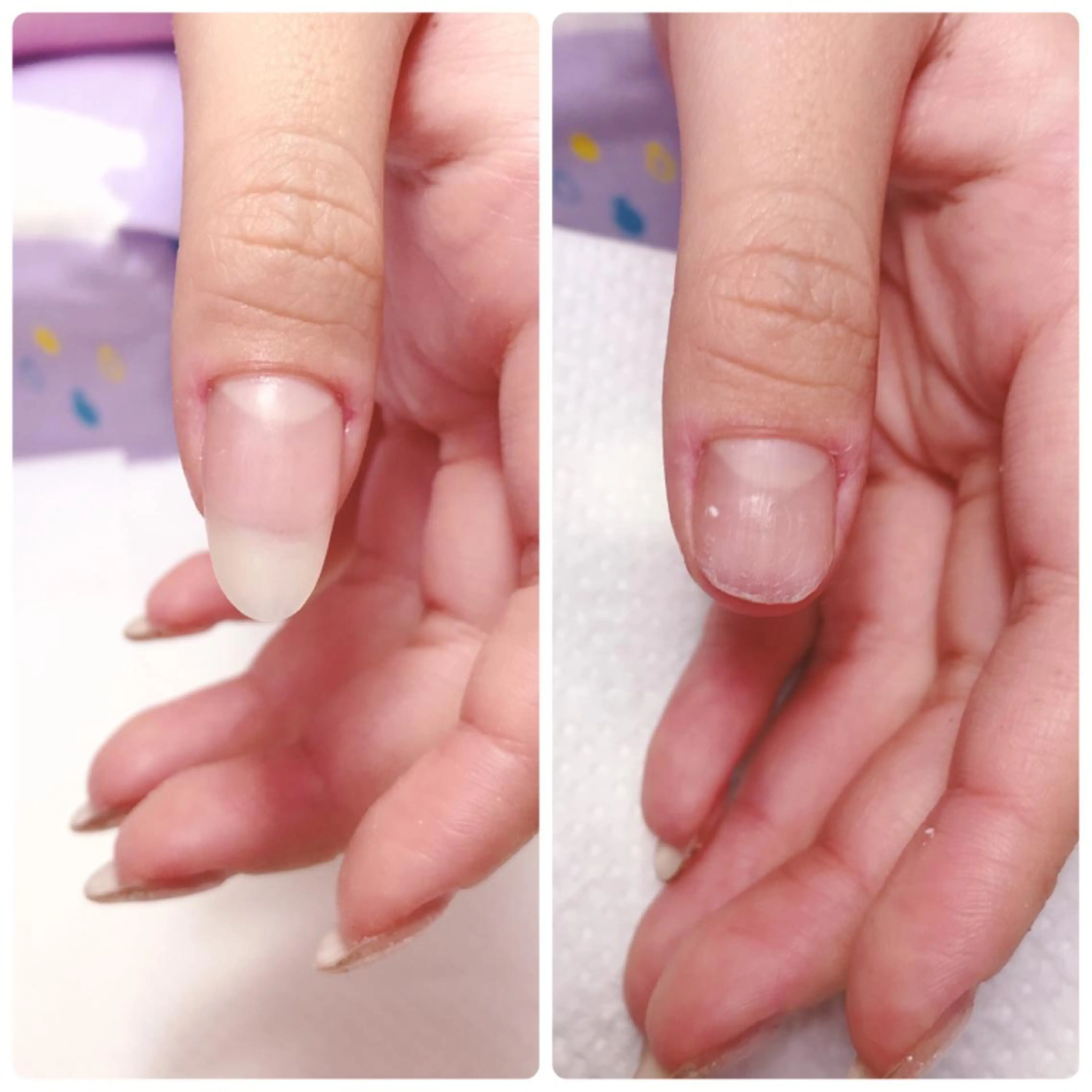 ネイル ハンドネイル 深爪を断らない スカルプ高評価店のネイルデザイン