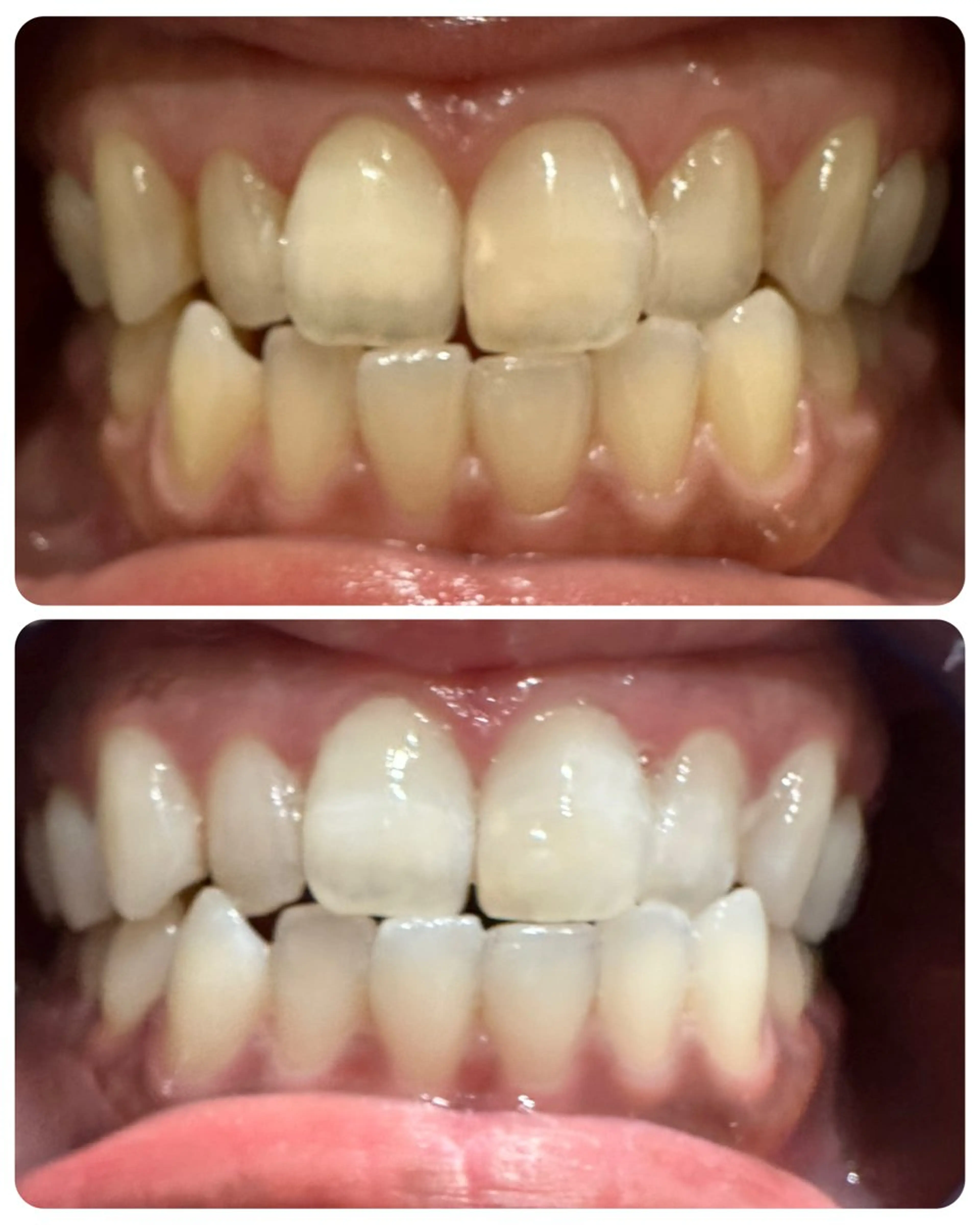 エステ The Salon 脱毛&眉毛スタイリング&セルフホワイトニング所属・The Salon 脱毛&眉毛の眉毛・アイブロウイメージ