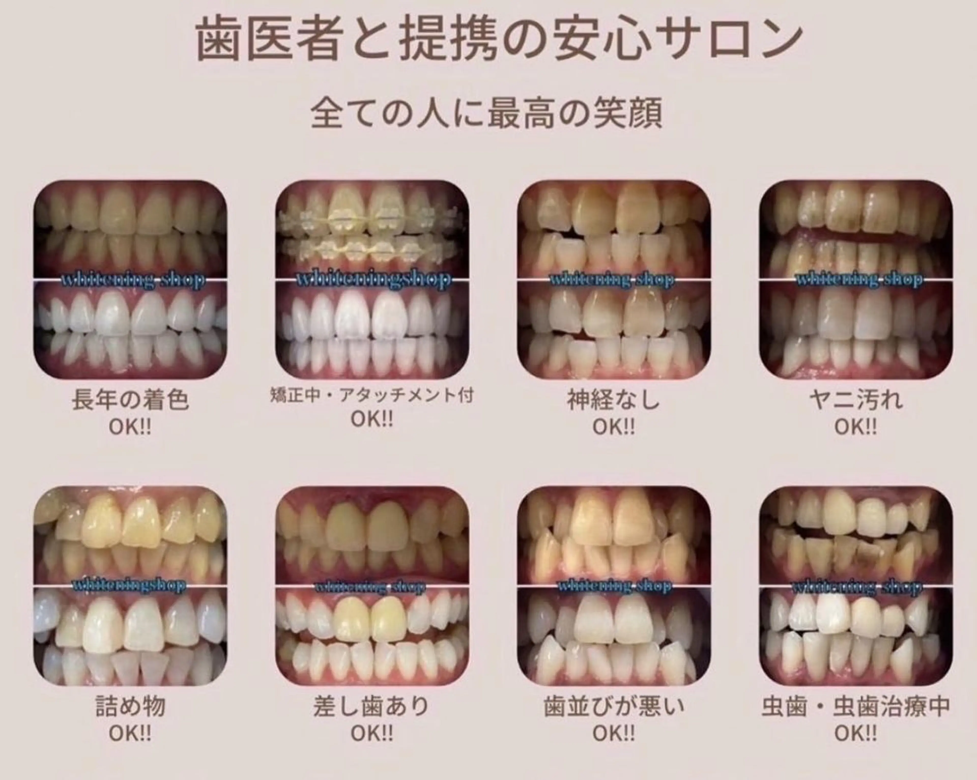 メンズ エステ リラク ホワイトニング ショップ船橋２号店のエステ・リラクイメージ
