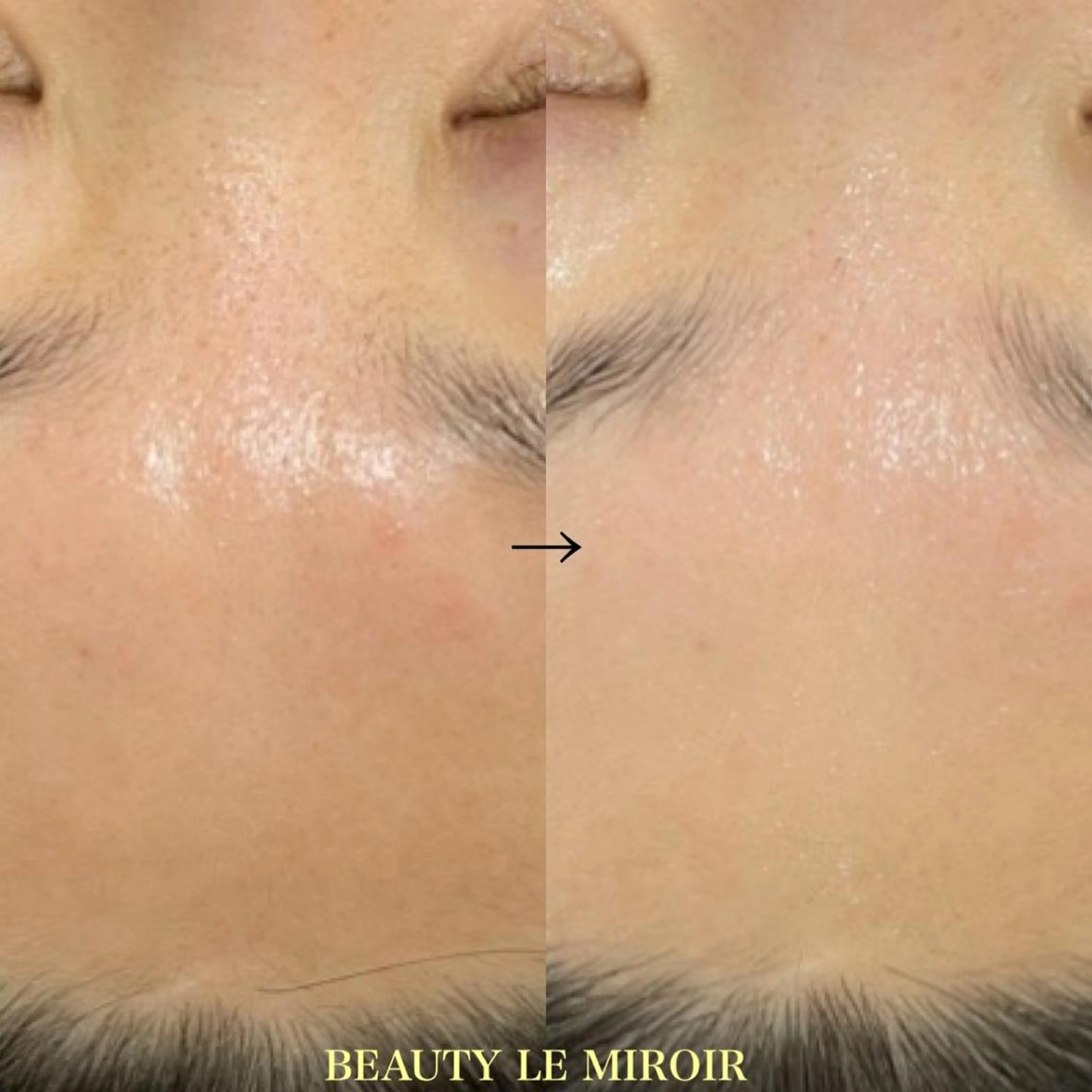 マツエク・マツパ ビューティー ミロワールのエステ・リラクイメージ