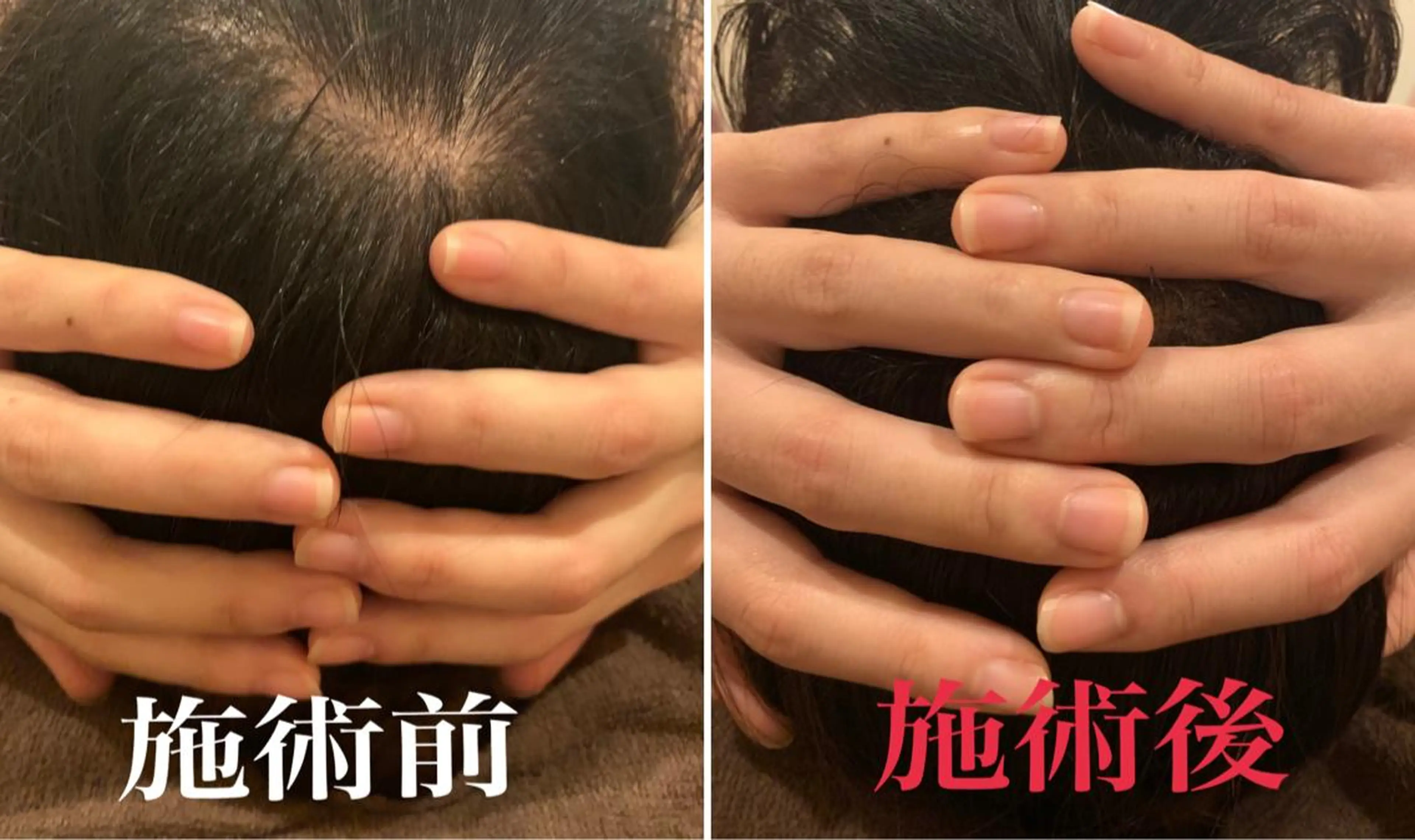 六本木　西麻布 ラヴィアンルフレットのエステ・リラクイメージ