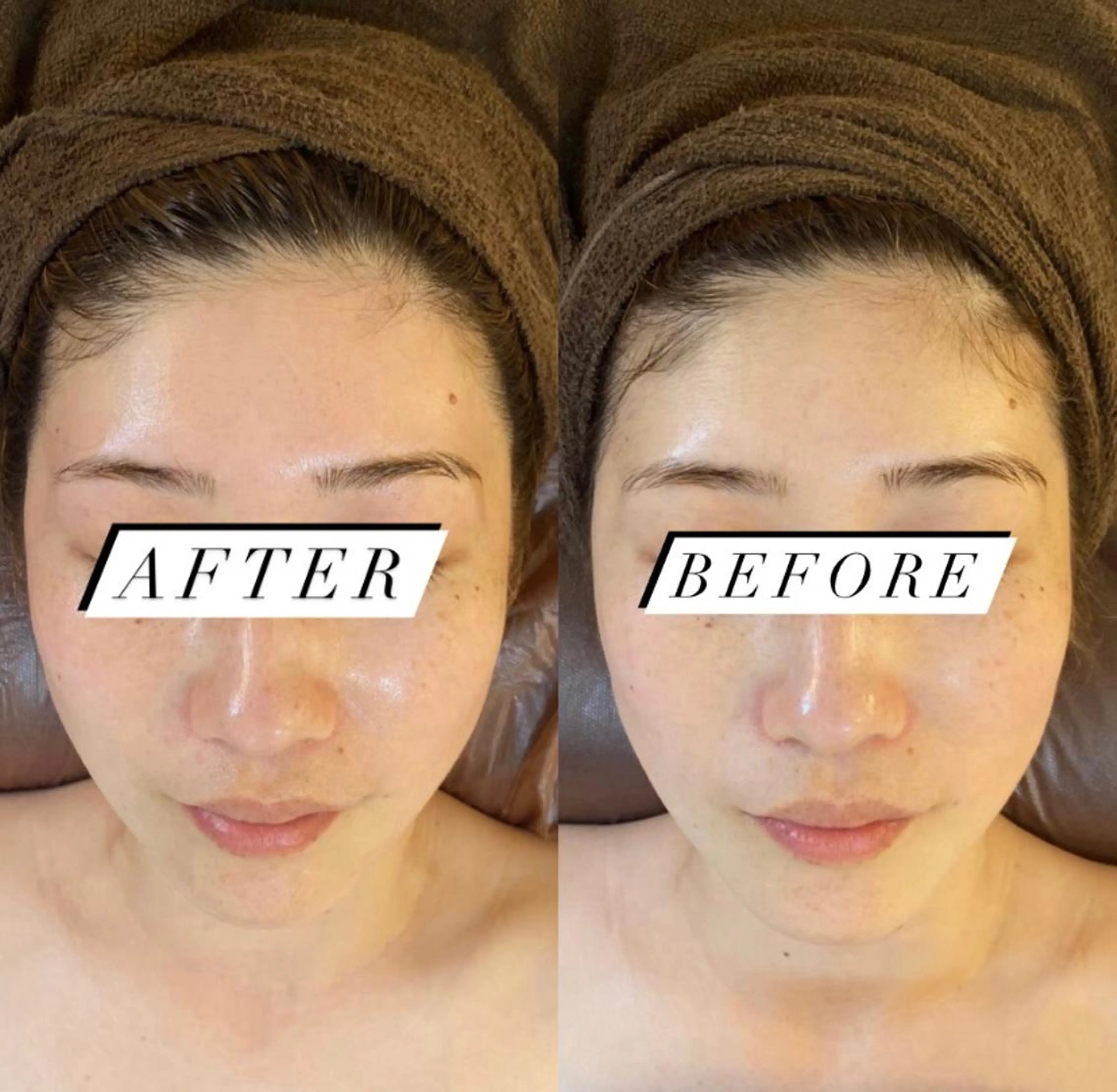 BELCIA福岡店　récolte de BELCIA（レコルトデベルシア）所属・BELCIA福岡店 レコルトデベルシアのエステ・リラクイメージ