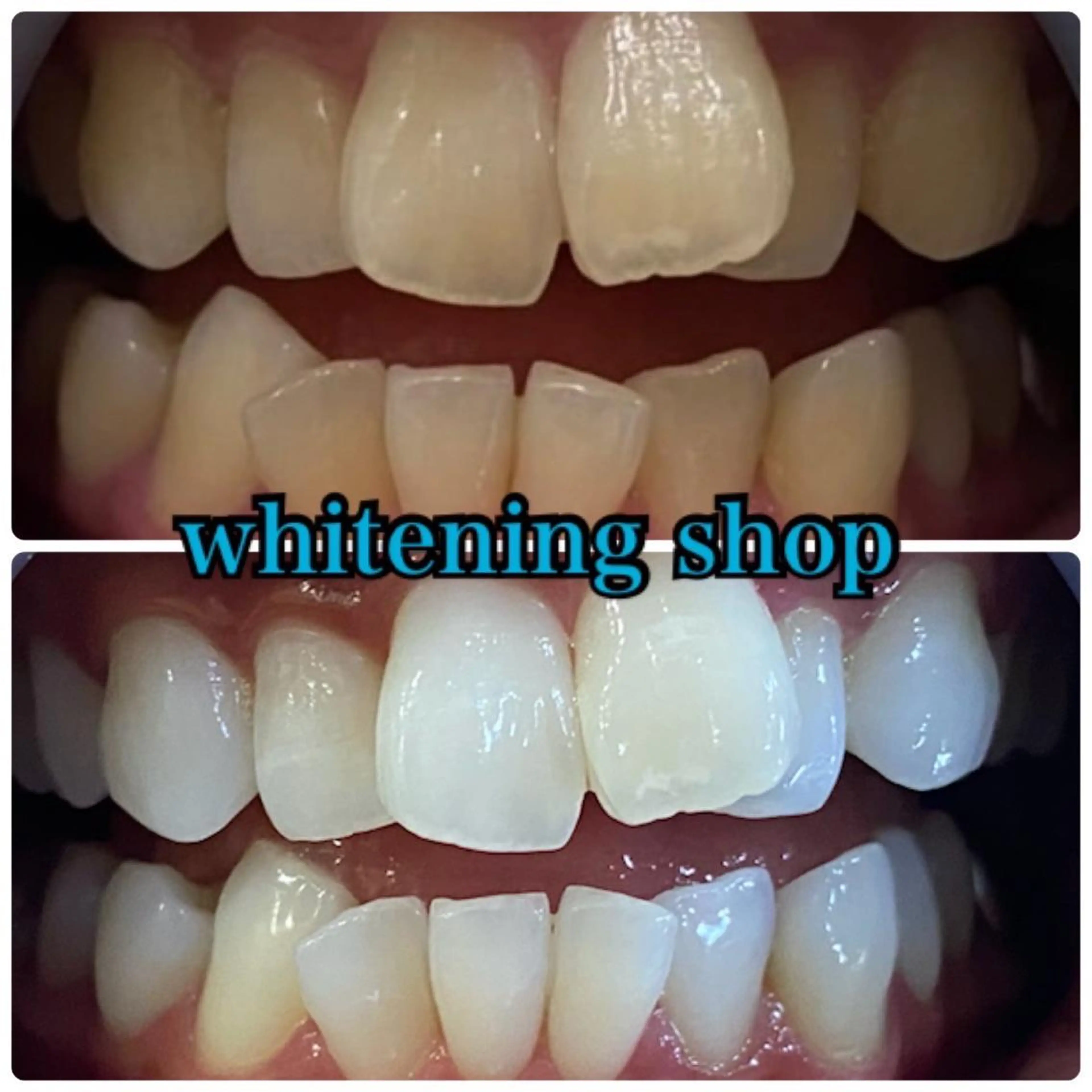 その他 ホワイトニング ショップ千葉店のその他イメージ