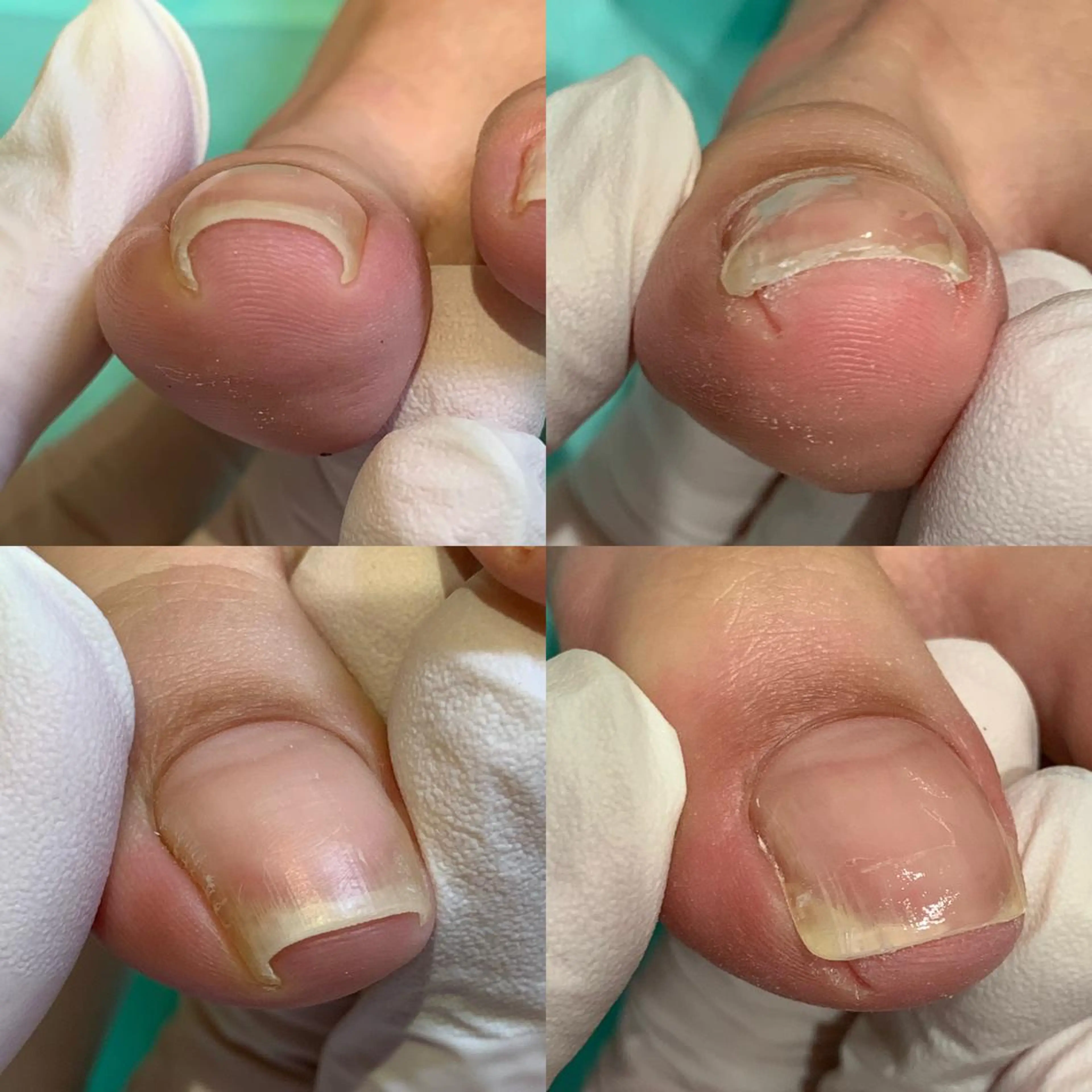 ネイル 東京巻き爪アカデミー所属・東京巻き爪 アカデミーのエステ・リラクイメージ