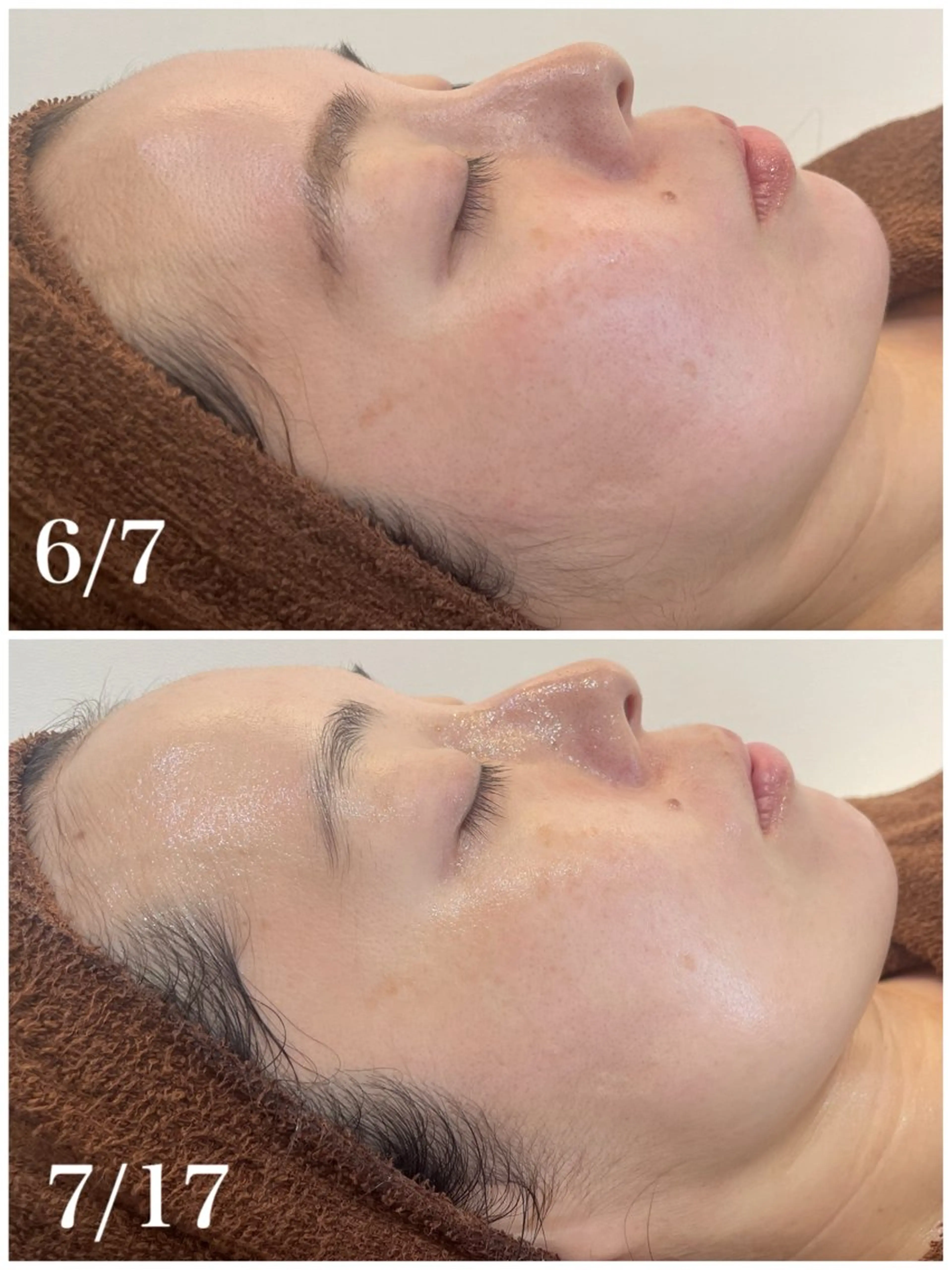 パーソナル肌質改善 🦋APRI🅿️有のエステ・リラクイメージ