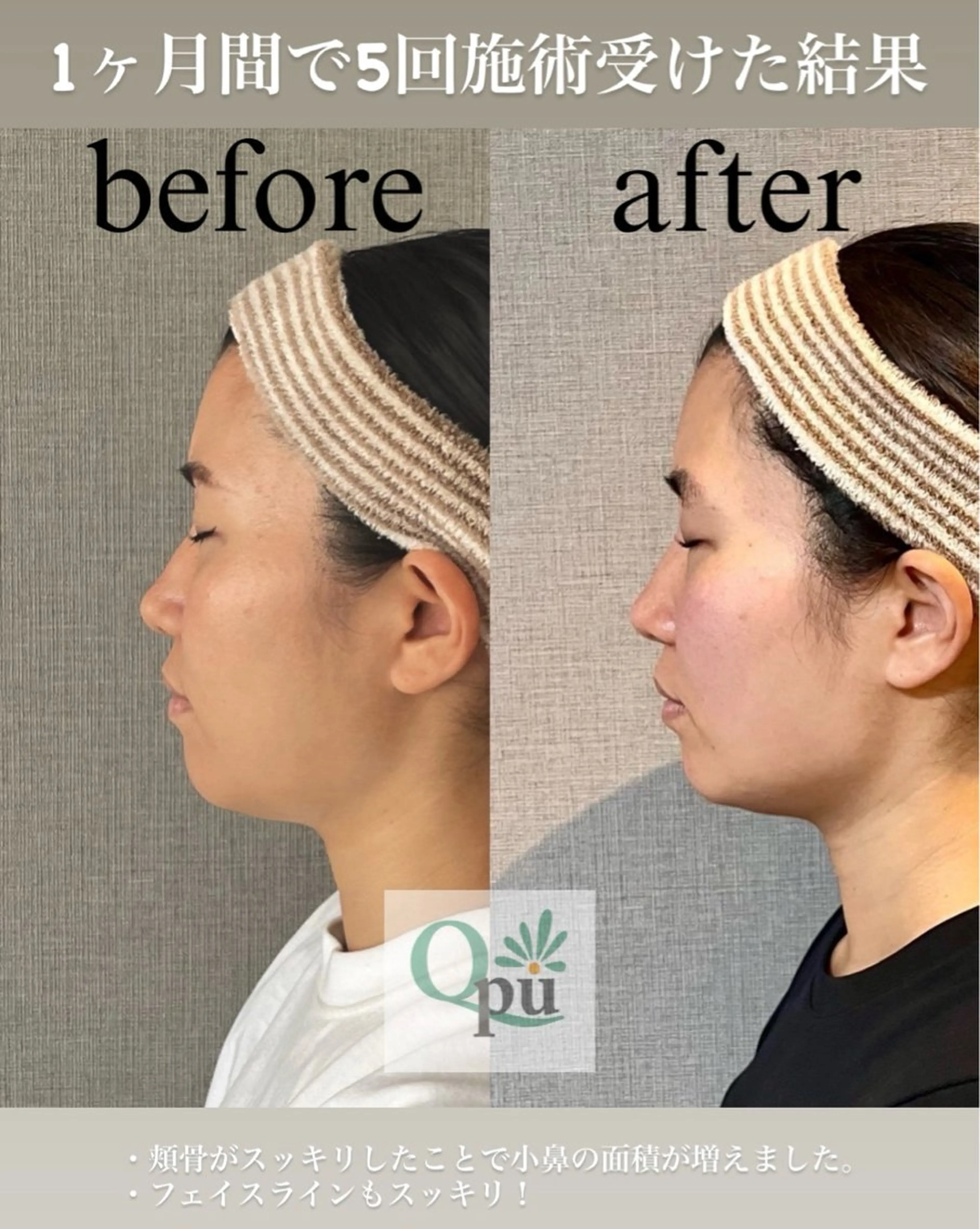 エステ リラク Qpu(キュープ)下北沢店所属・鮎川 さゆりのエステ・リラクイメージ