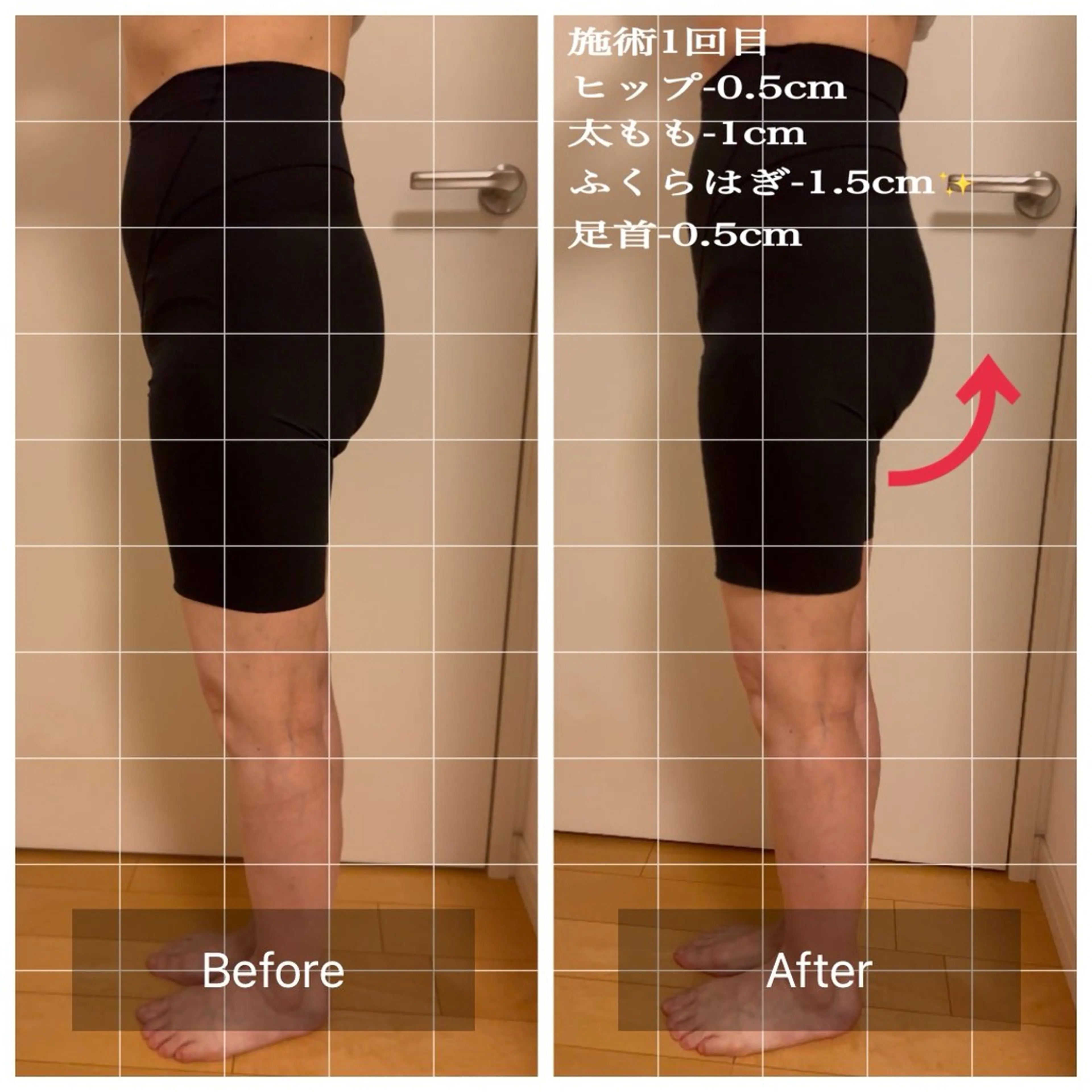 変わりたい女性必見！！ヒップアップ！むくみも解消『きゅんきゅんヒップ』60分の写真