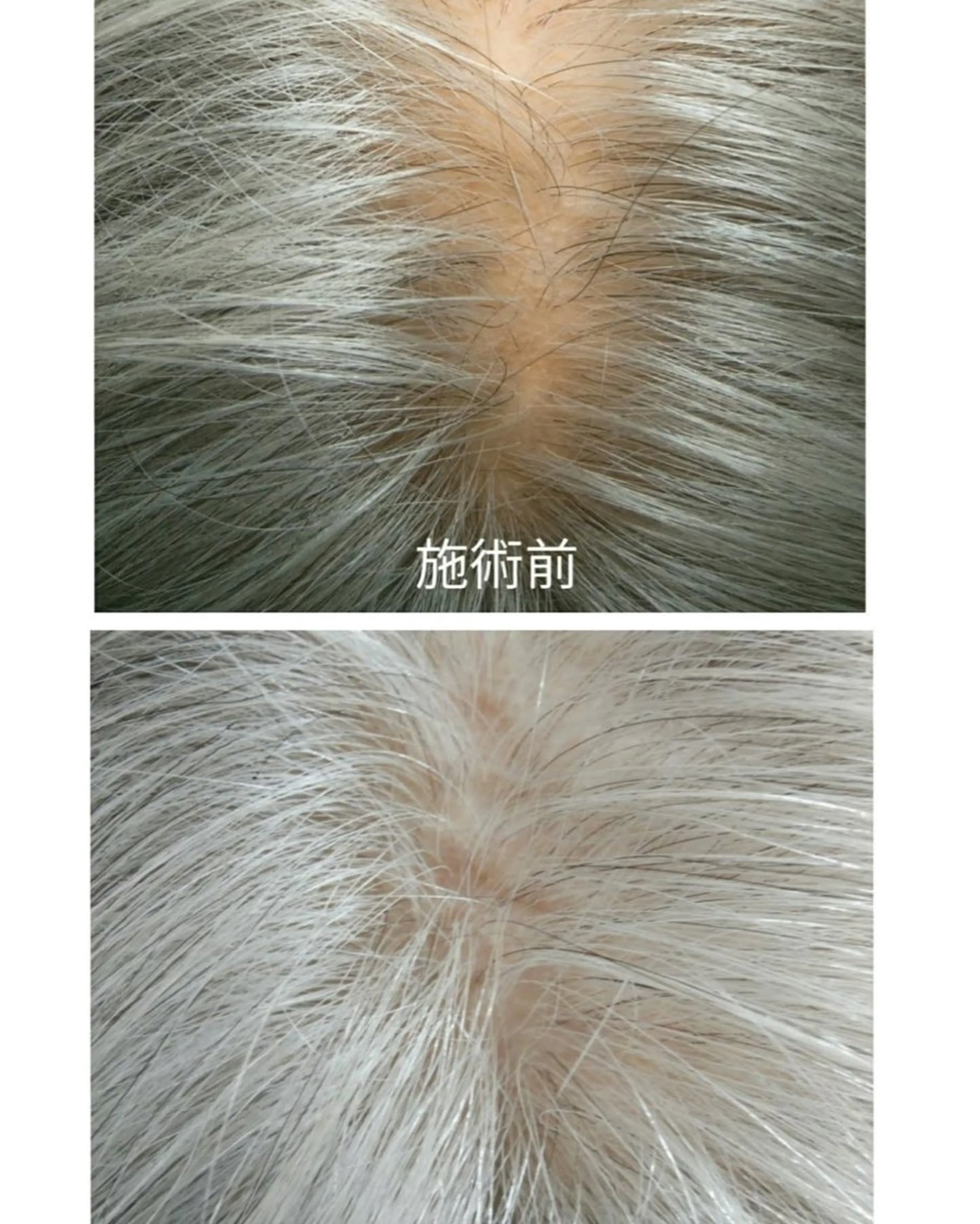 増毛エクステ 800本の写真