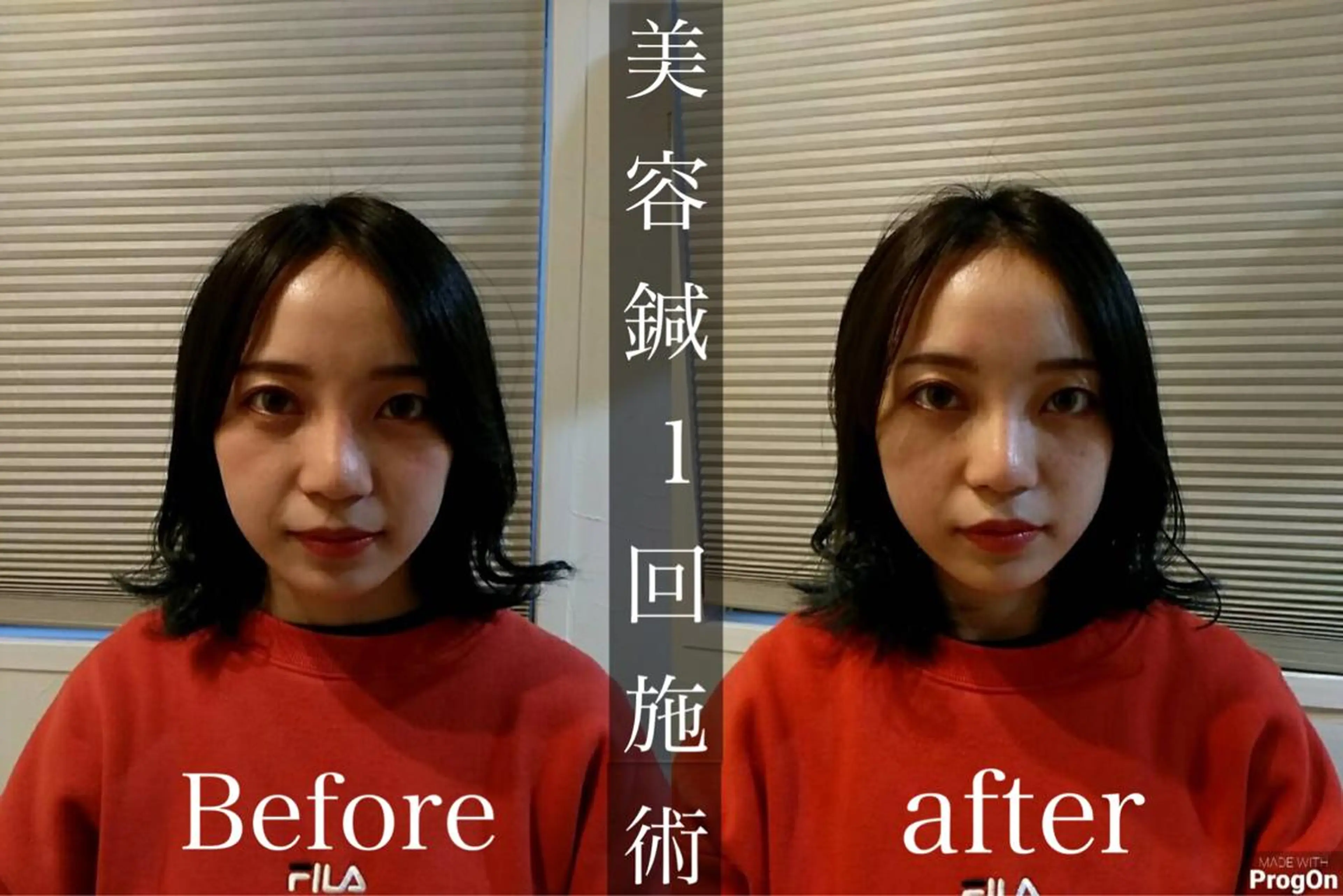 鍼灸整骨院Refine所属・鍼灸 Refineのその他イメージ