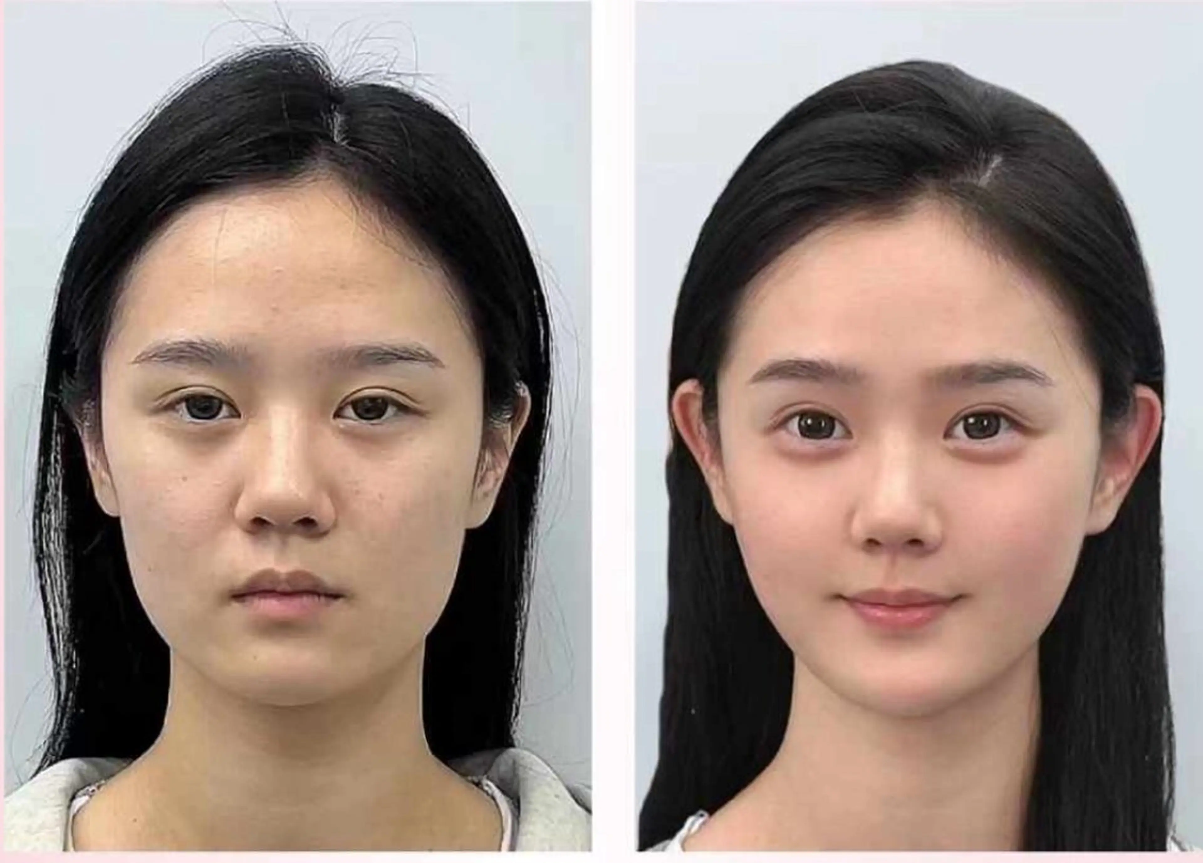 ネイル エステ リラク 愛維美水光美肌専門店所属・愛維美水光美肌専門店 メンズレディースokのエステ・リラクイメージ