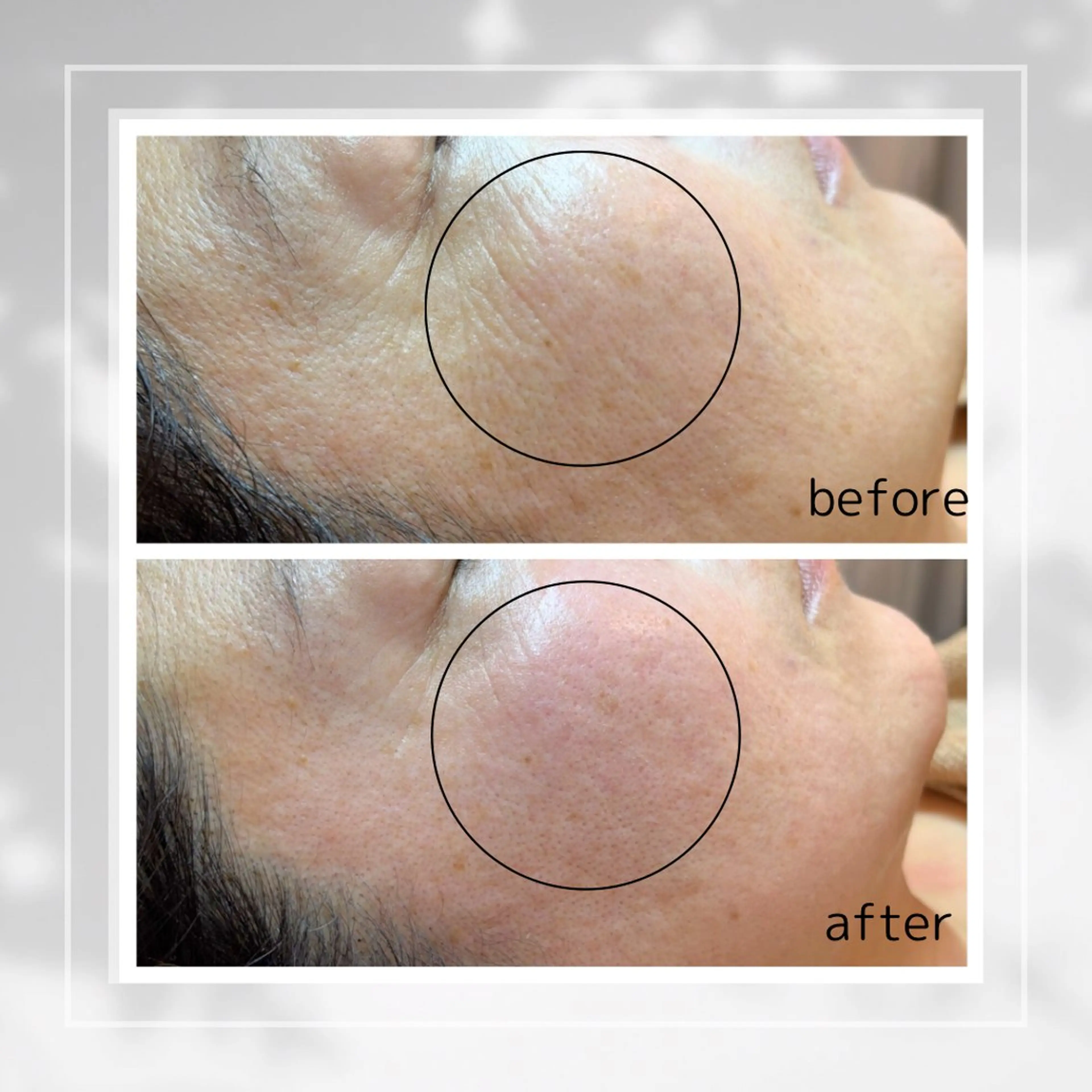 エステ 肌質改善フェイシャルCLEAR栄生/リンパ/毛穴/シミケア所属・井戸 麻衣のエステ・リラクイメージ