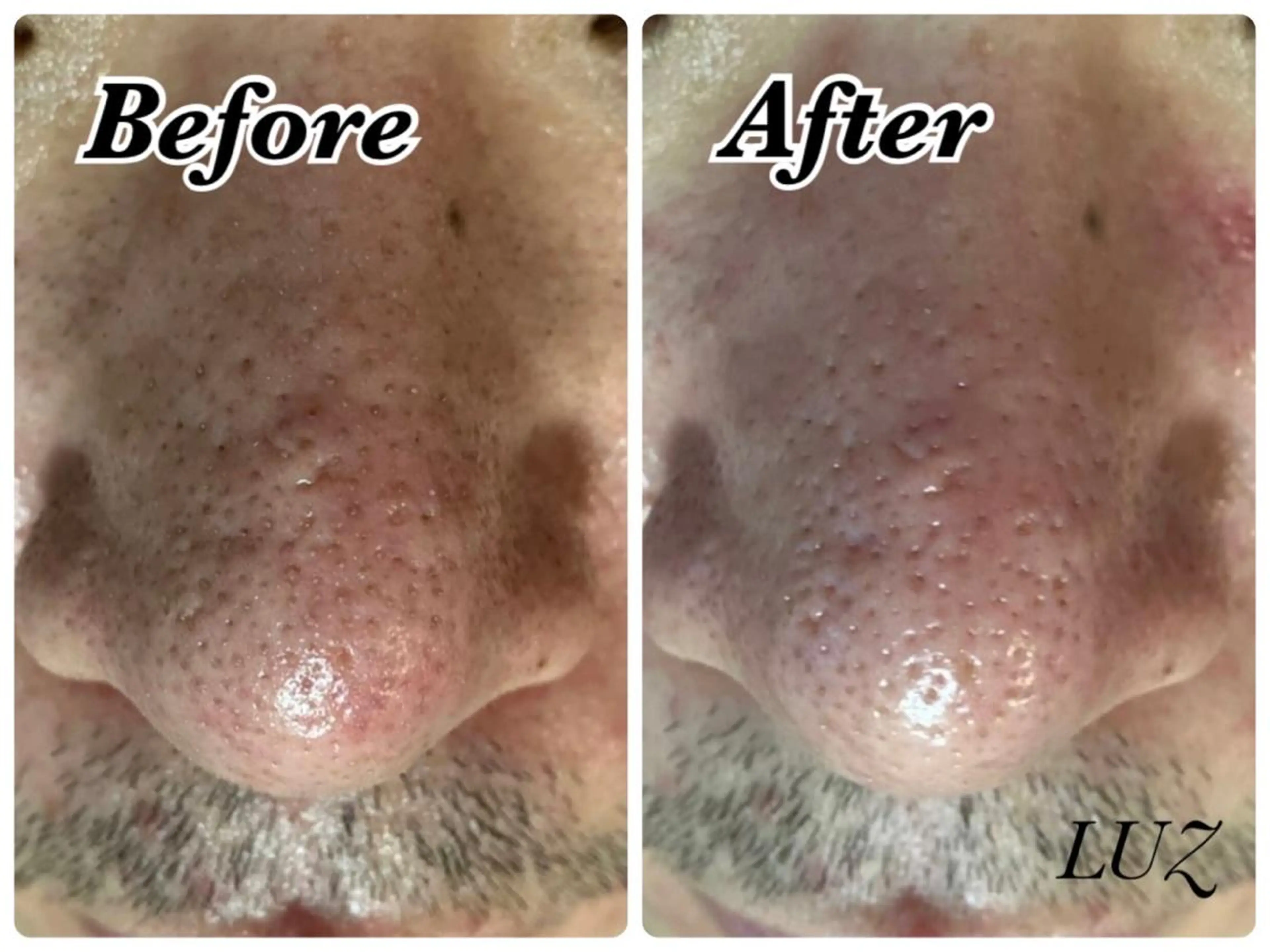 メンズ エステ メンズフェイシャル アイブロウ・ルースのエステ・リラクイメージ