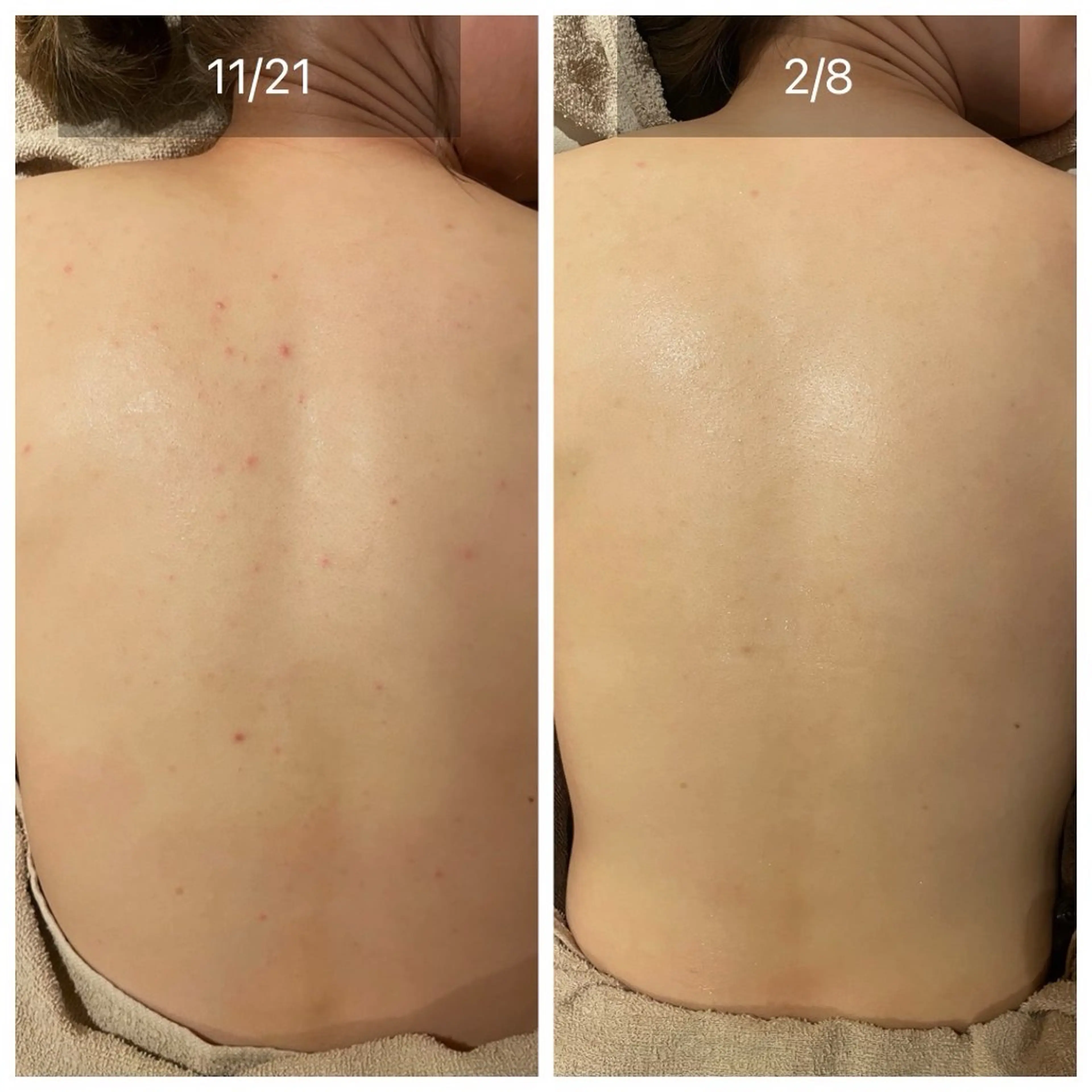 その他 for woman所属・森 美優のエステ・リラクイメージ