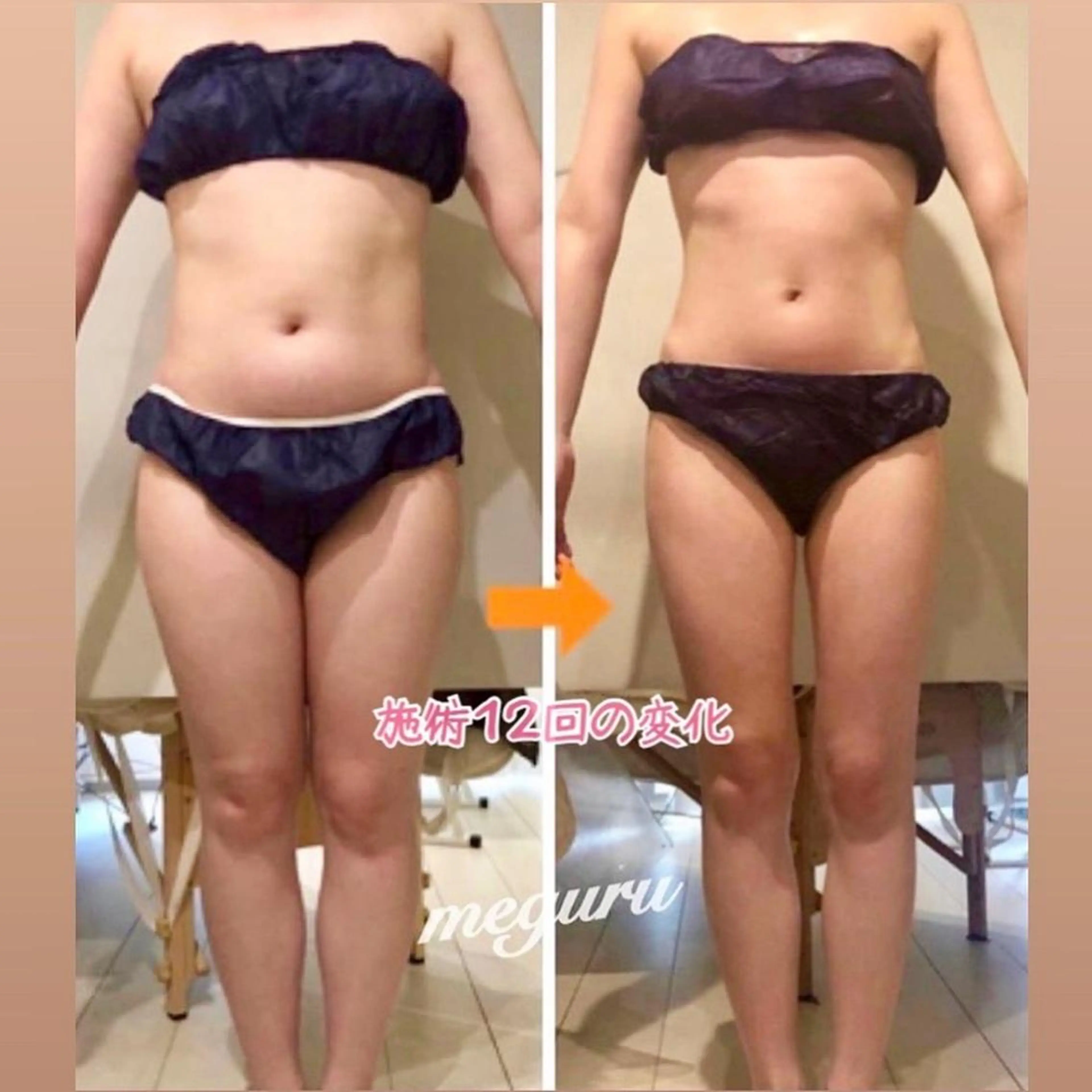 ショート カラー パーマ ヘアアレンジ メンズ キッズ ネイル マツエク・マツパ エステ リラク ‍痩身＆ボディ 結果出し🌟丹野のエステ・リラクイメージ