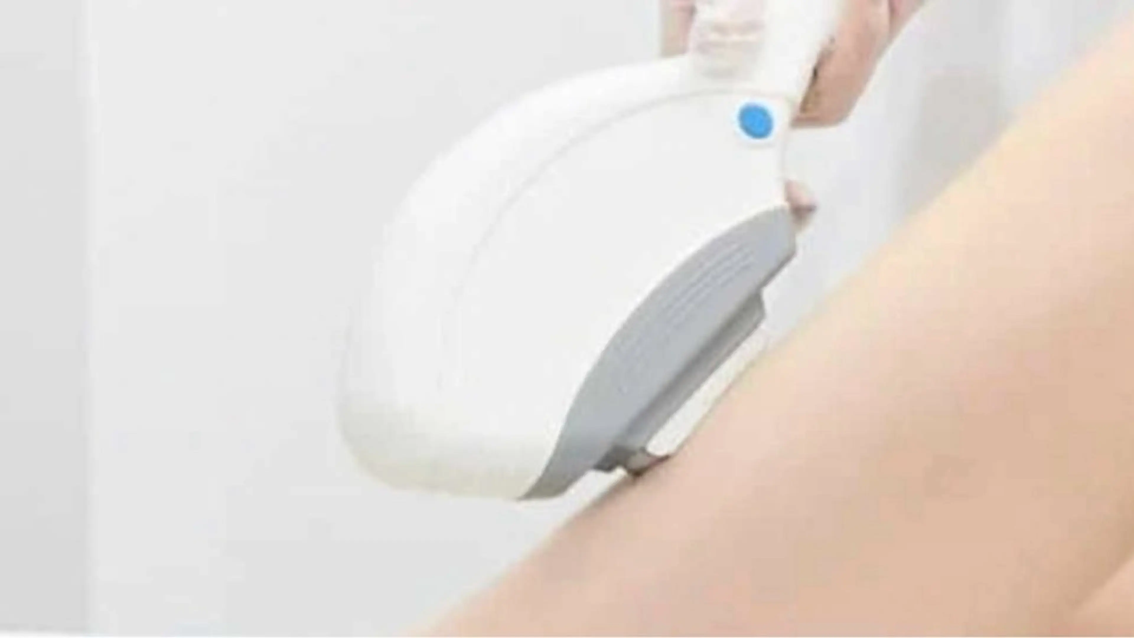 メンズ部分脱毛　１箇所の写真