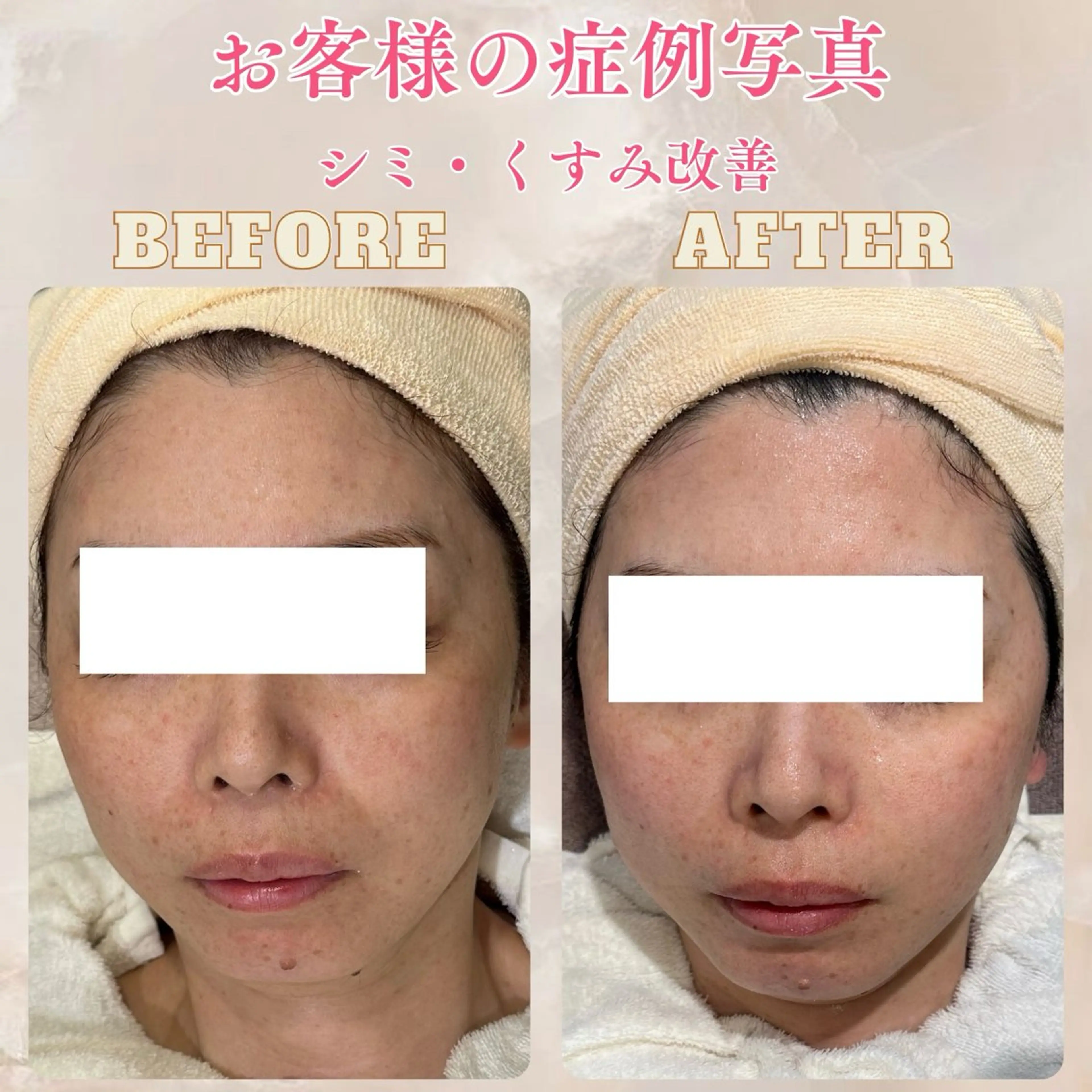 エステ pansy(パンジー)上野フェイシャルエステ専門店所属・pansy saraのエステ・リラクイメージ