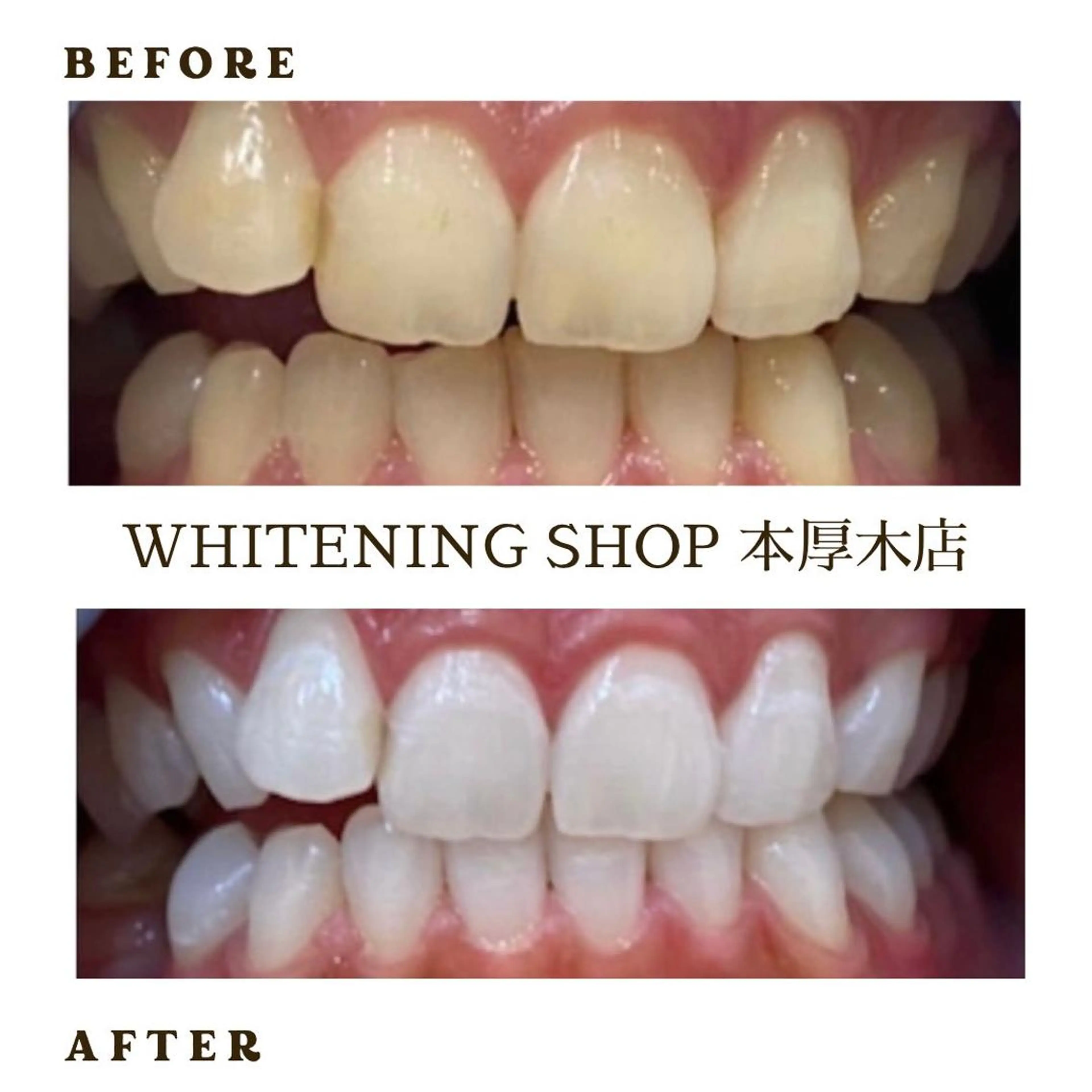 メンズ その他 ホワイトニング ショップ本厚木のその他イメージ