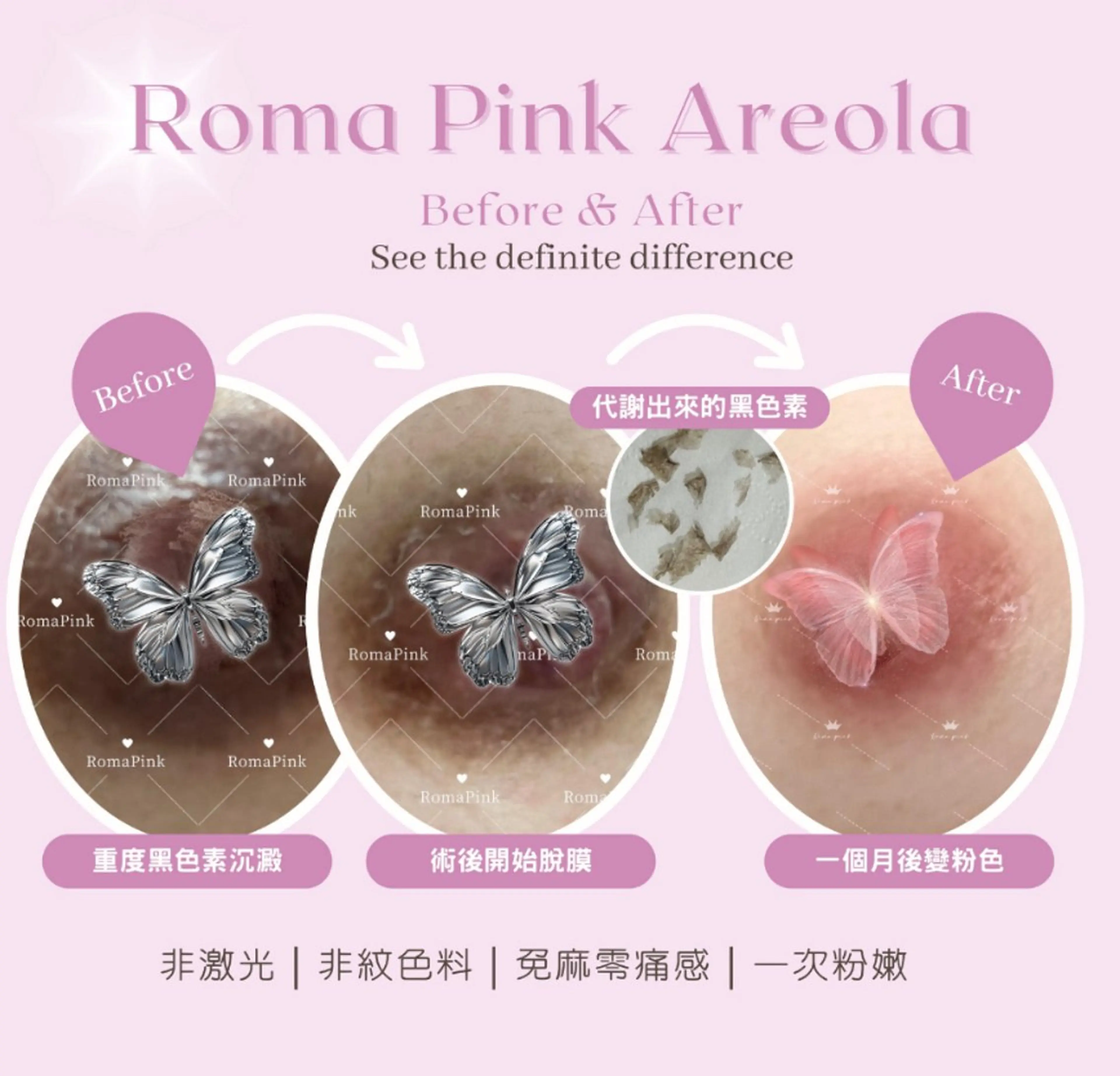 🩷ローマピンク🩷　ニップル　半額キャンペーンの写真