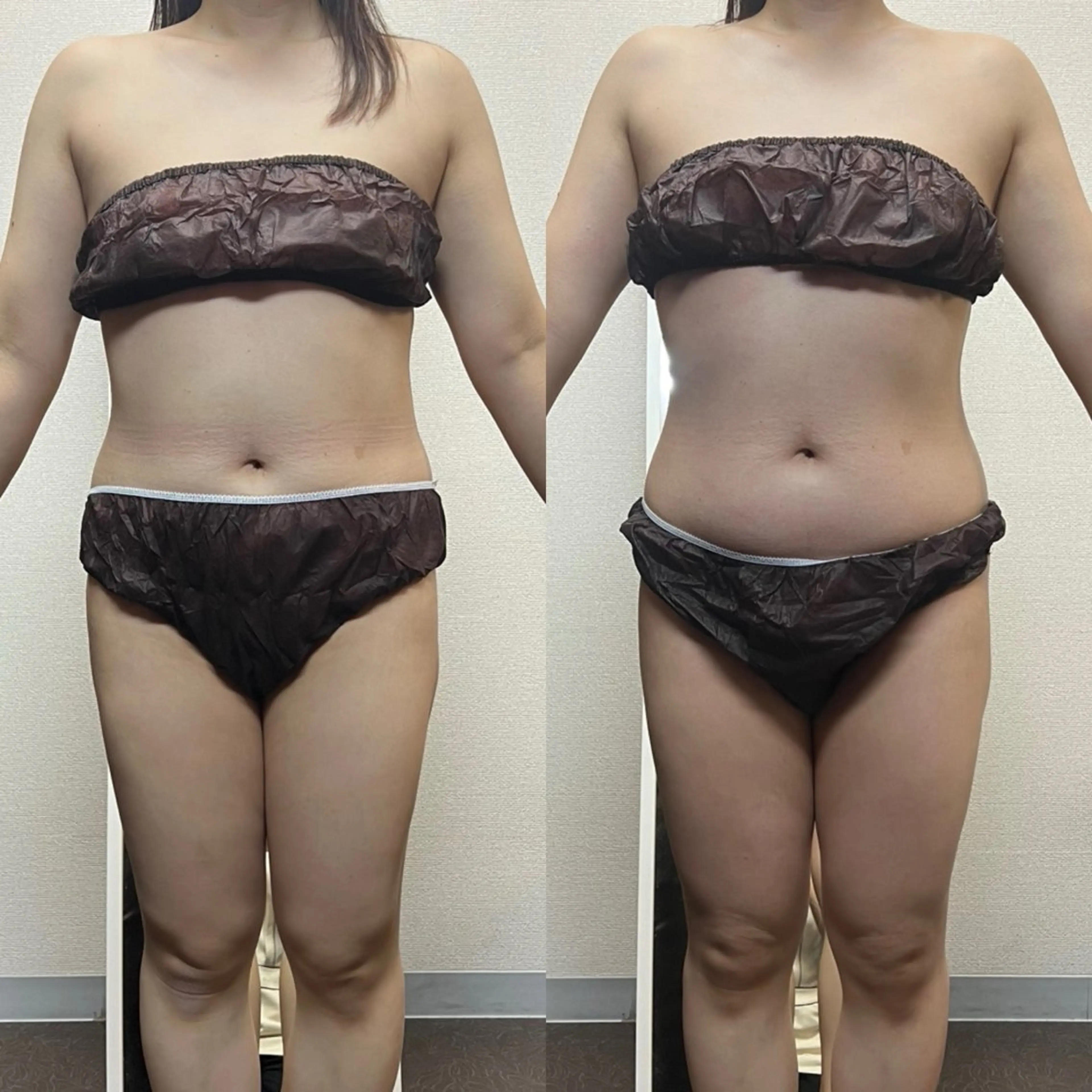 エステ ハイパーナイフ専門店　Salon de COCO所属・Salon de COCOのエステ・リラクイメージ