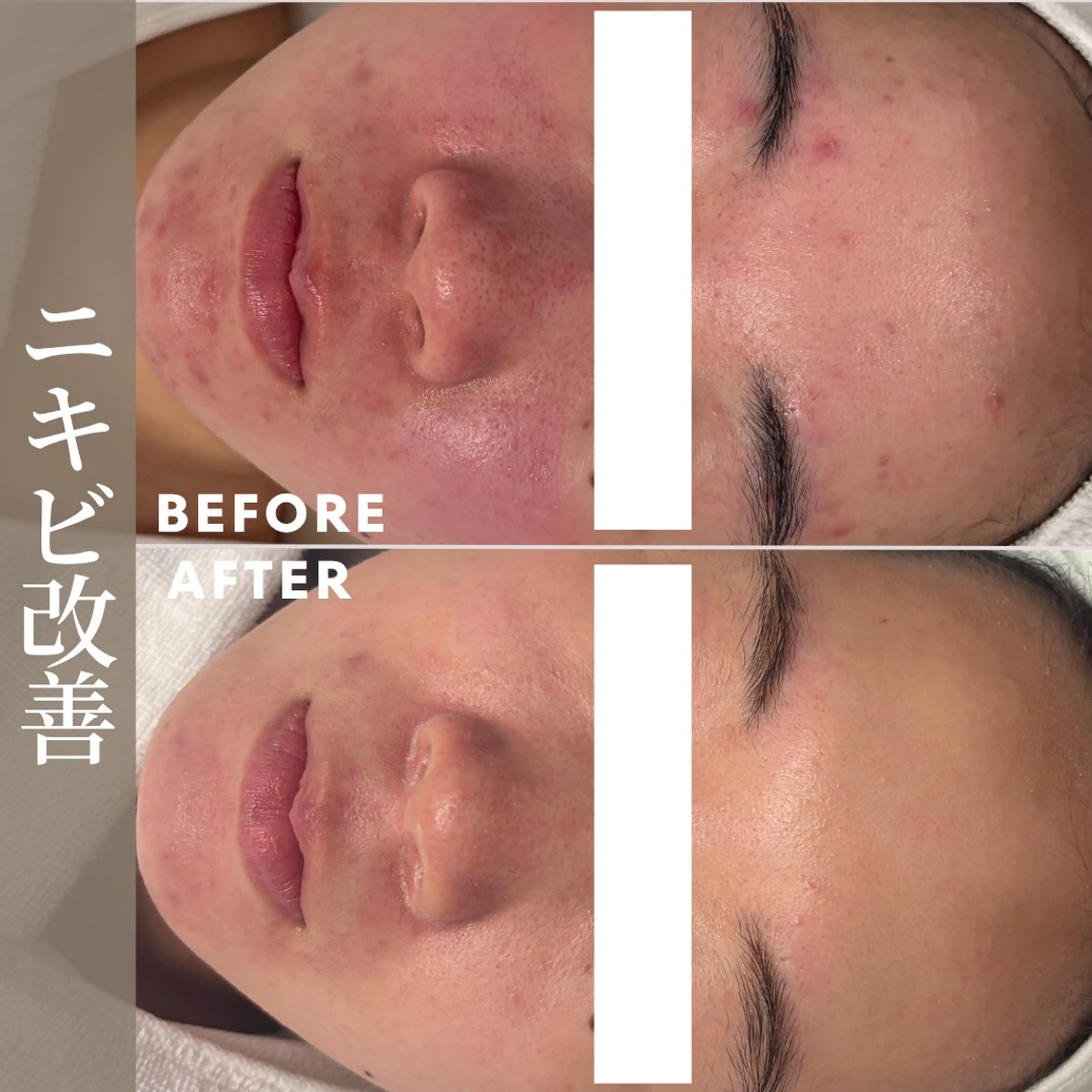 肌育成サロン ♡ RISAのエステ・リラクイメージ