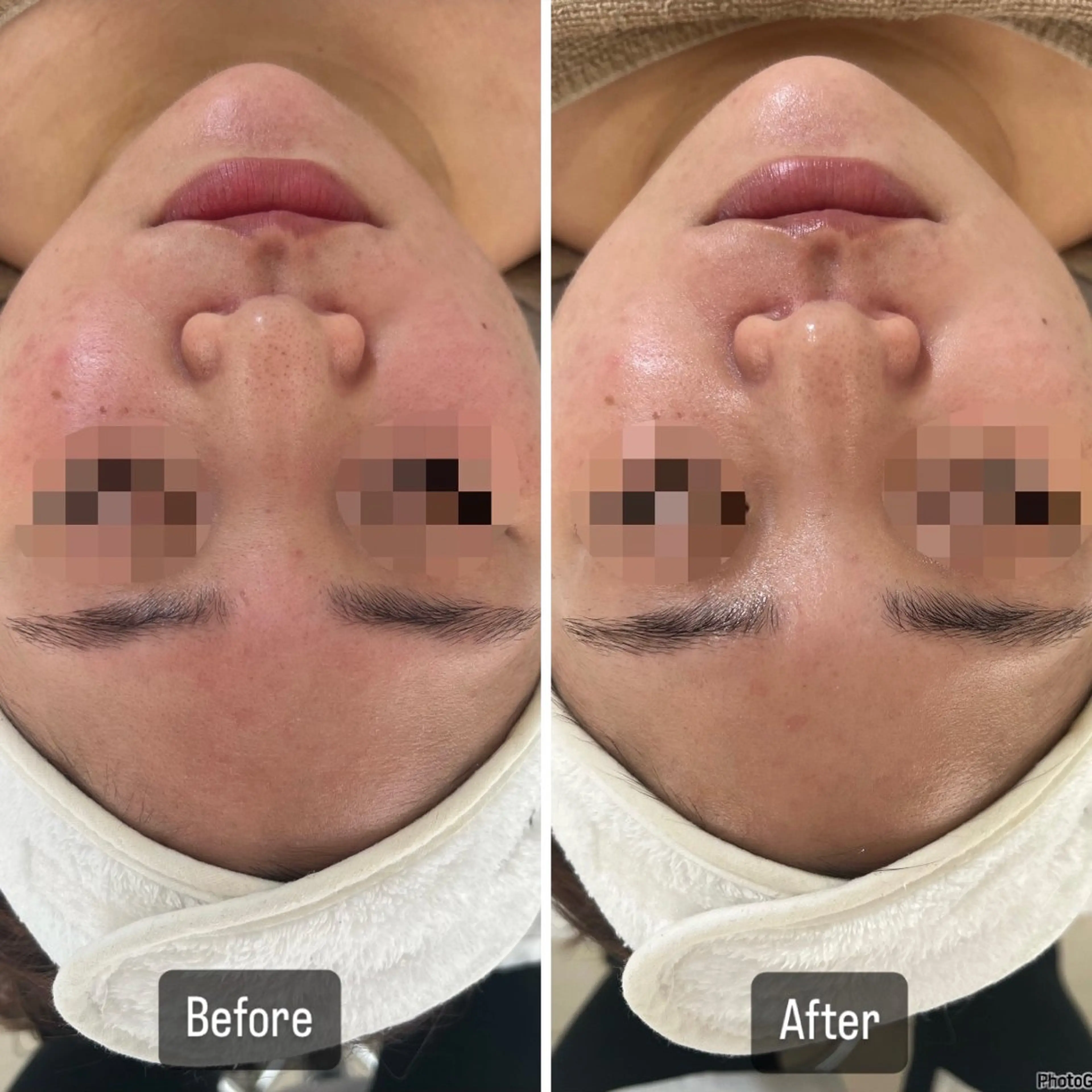 エステ 脱毛＆Beauty salon IILA所属・垢抜けお手伝い💖 Sakuraの眉毛・アイブロウイメージ