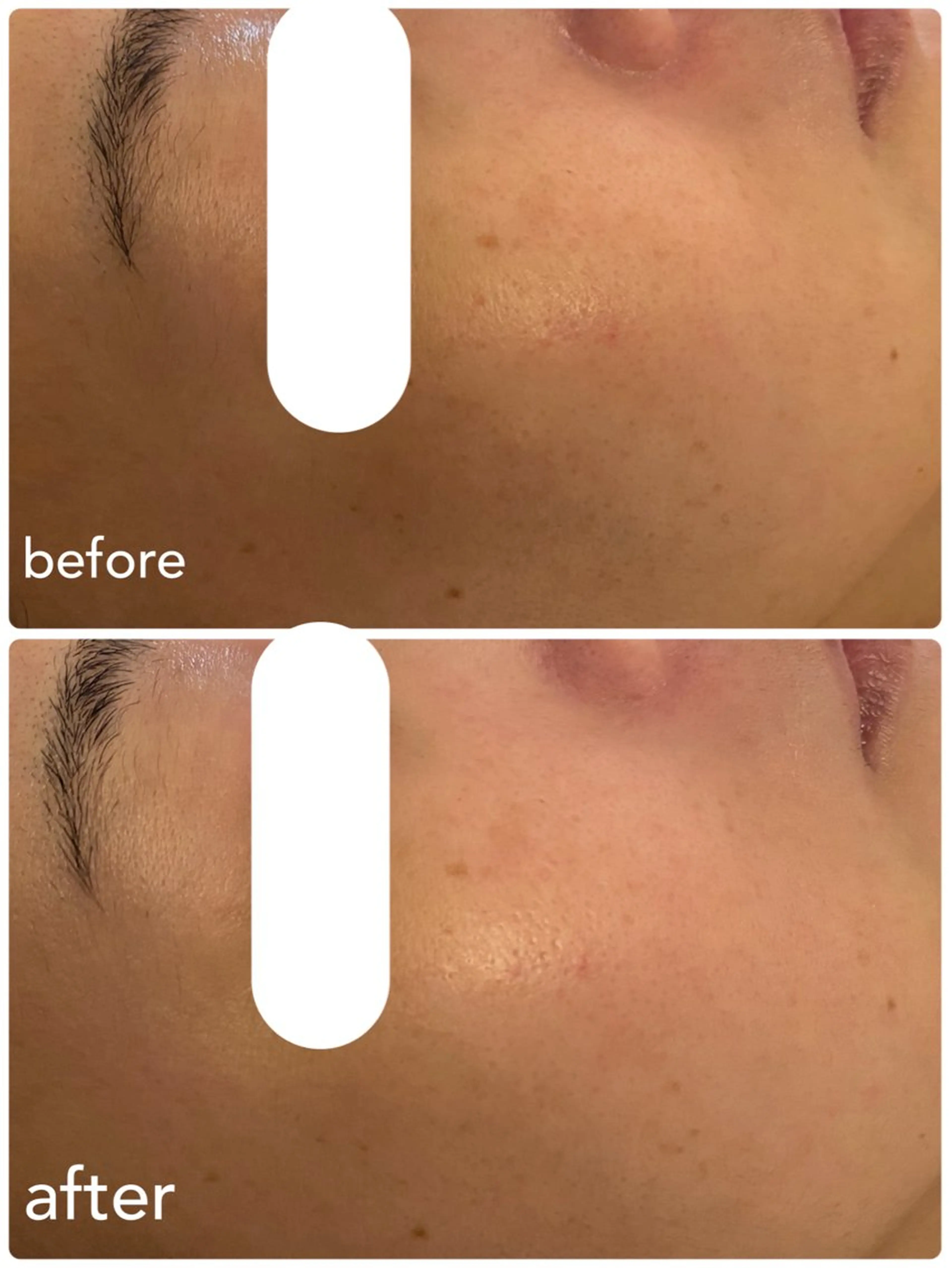 エステ 【堺市/泉ヶ丘駅】フェイシャルエステサロンSalon de jewel'm所属・Salon de jewel'm なおのエステ・リラクイメージ