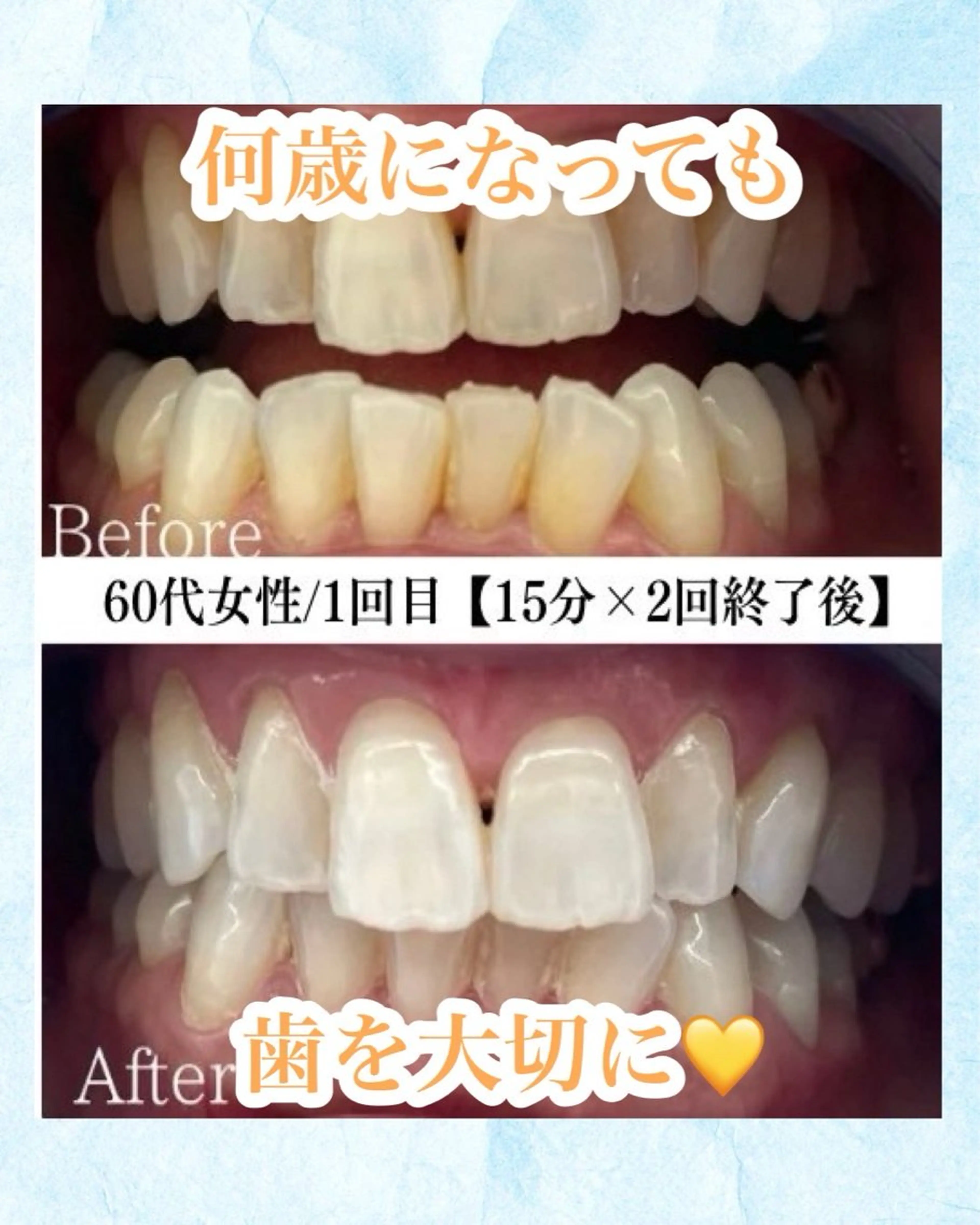 メンズ キッズ ビジネス エステ リラク ホワイトニング専門店 WHITE天神店のエステ・リラクイメージ