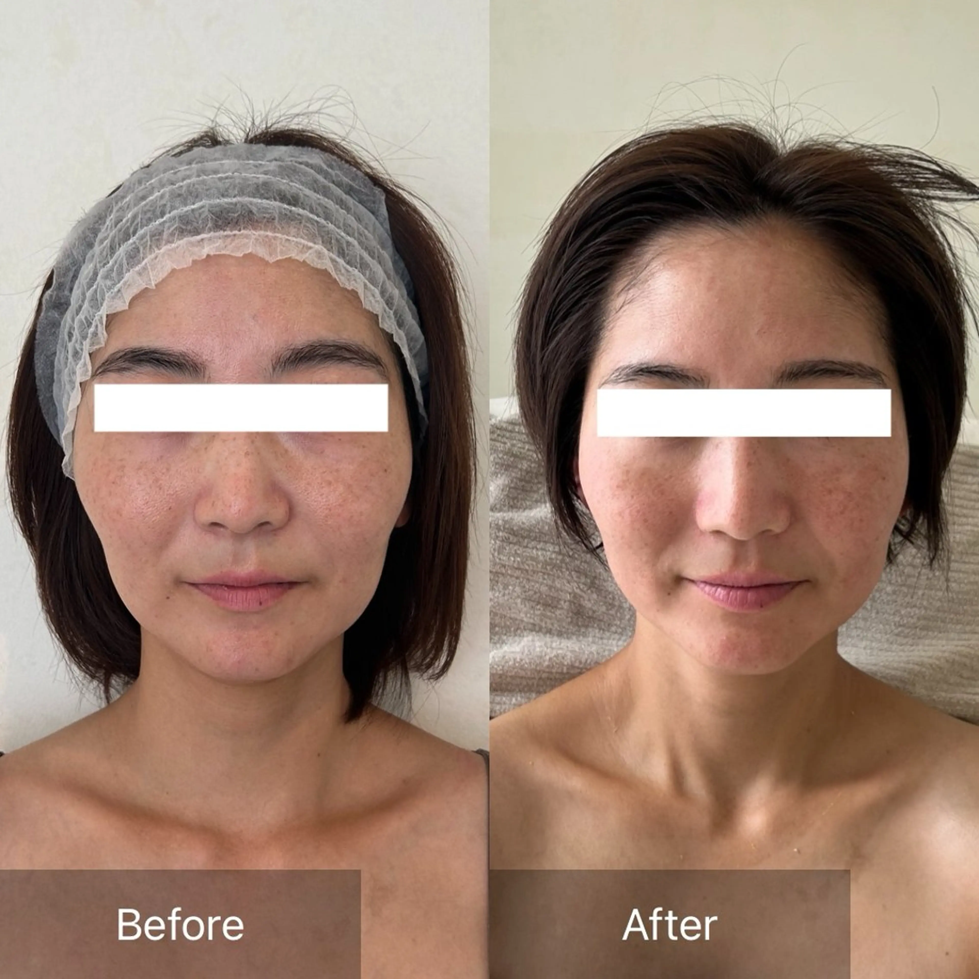 Charis エステ&ネイルのエステ・リラクイメージ