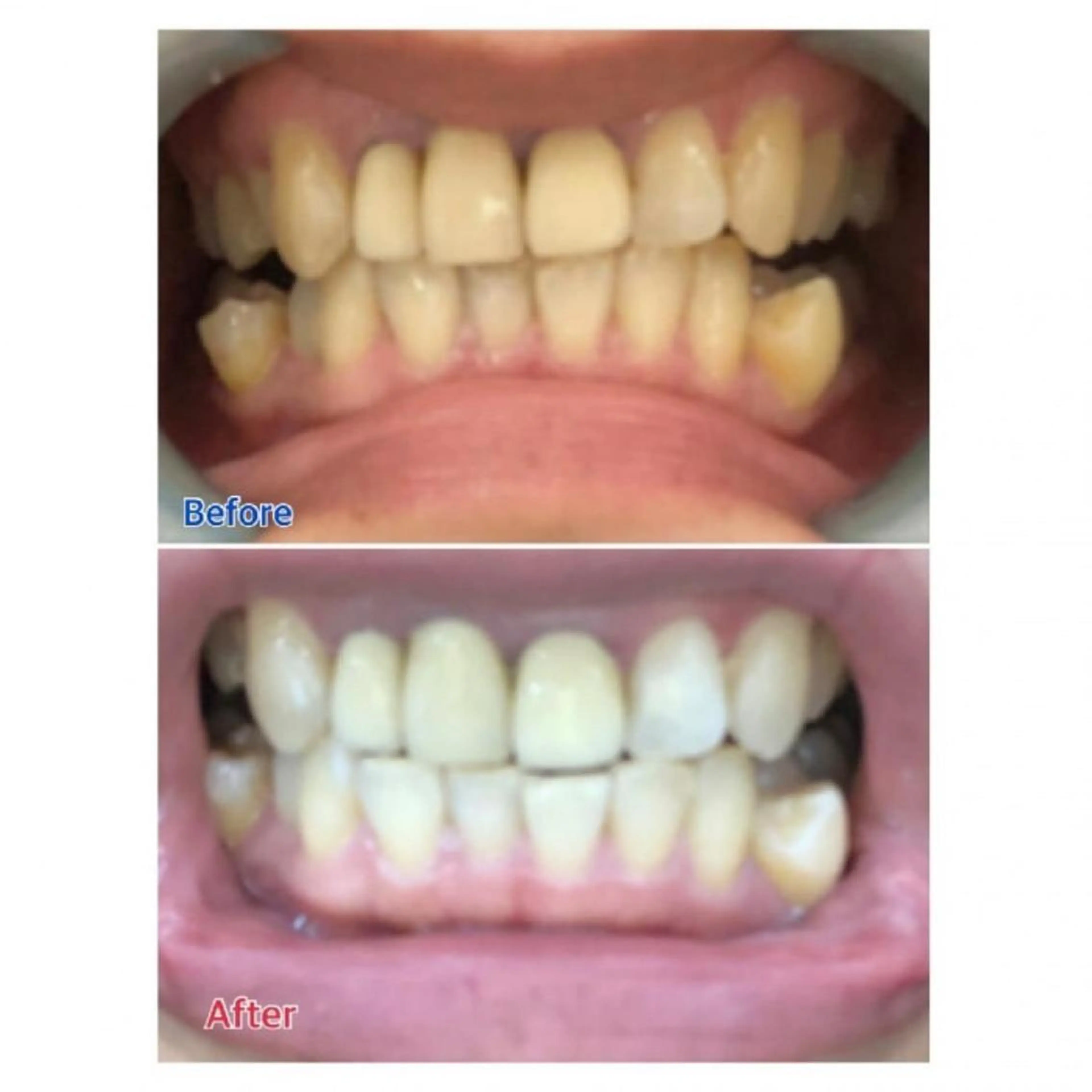 M渋谷店所属・M渋谷 ホワイトニングのエステ・リラクイメージ