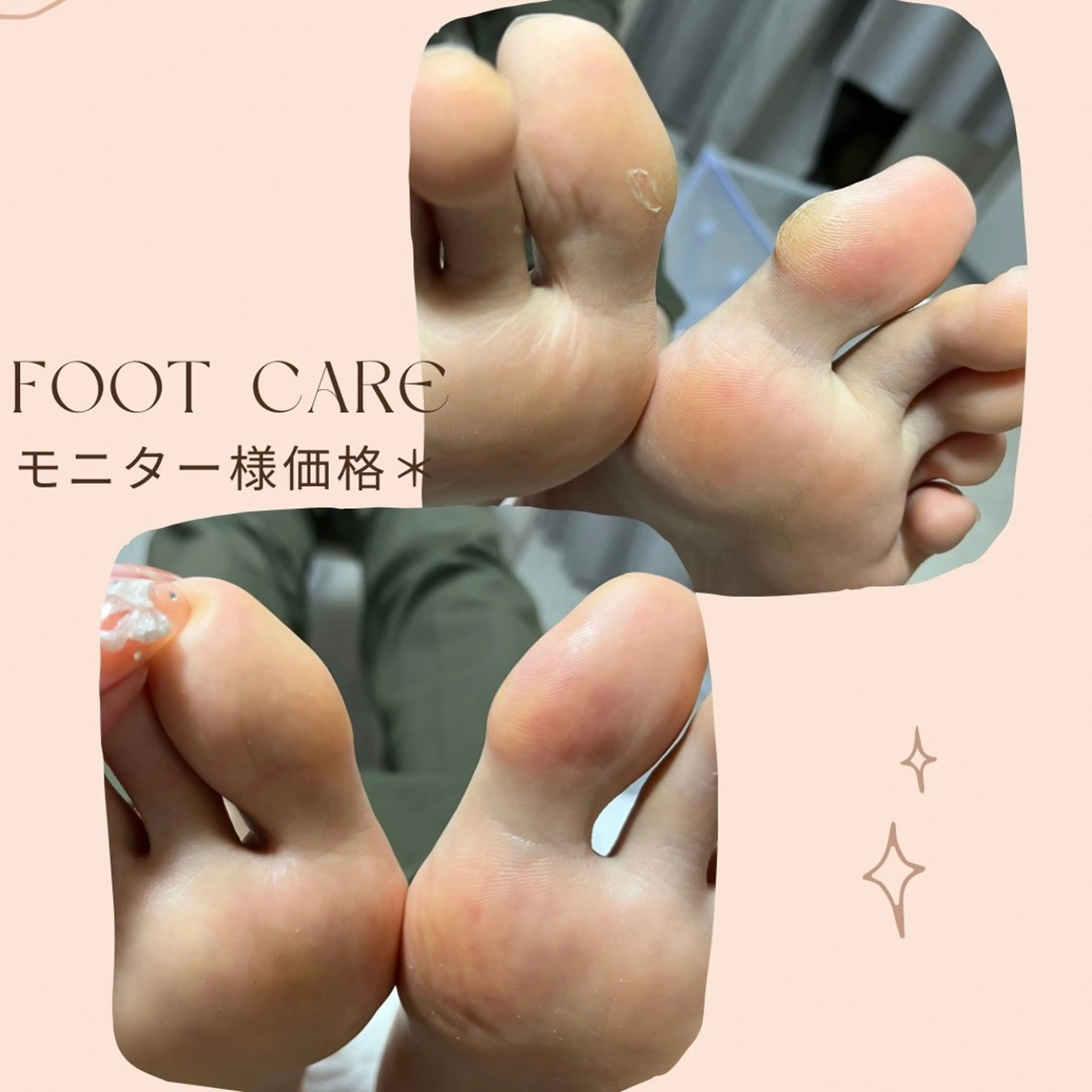 フット角質ケア ＊ ￥3300の写真