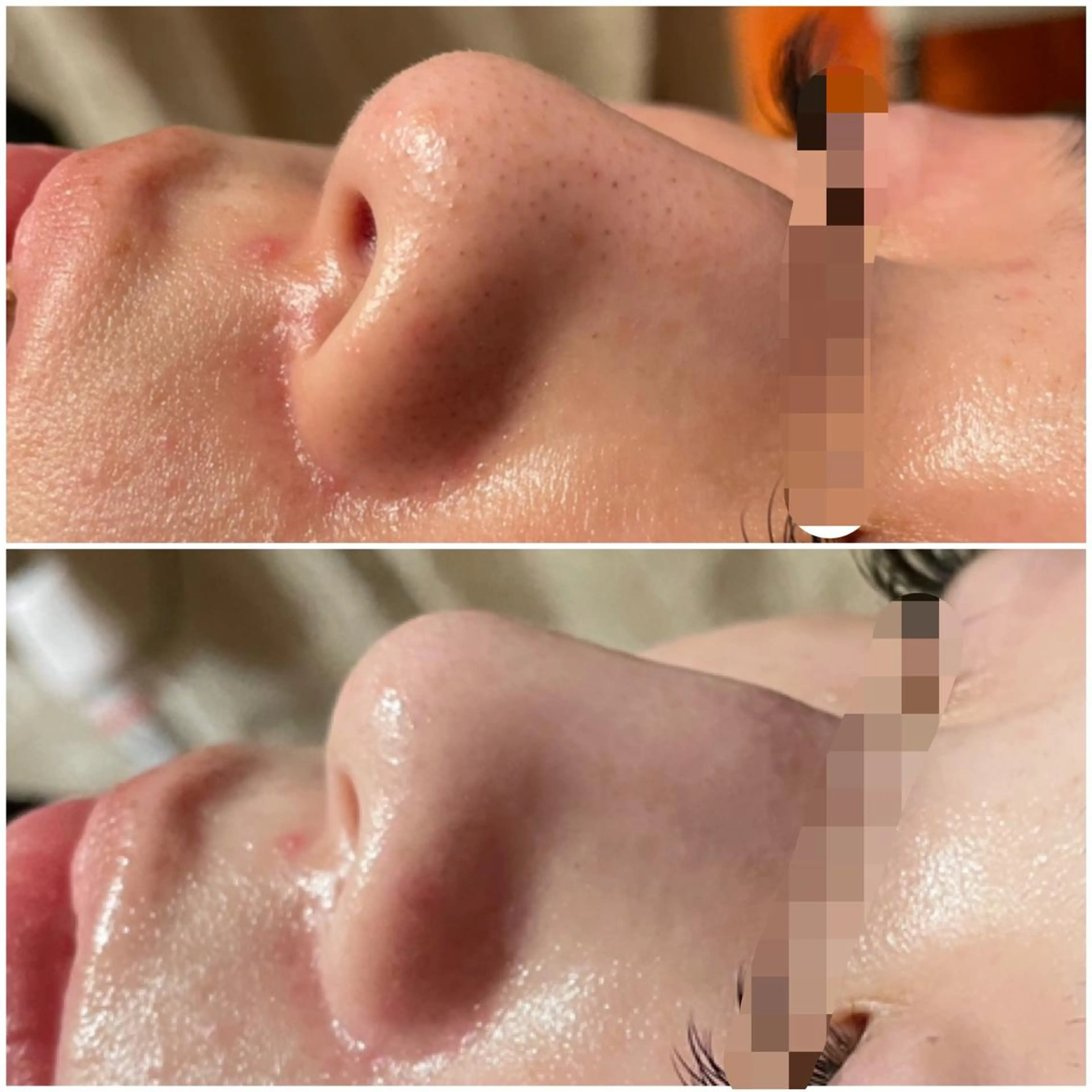 エステ Shelly Graceのエステ・リラクイメージ