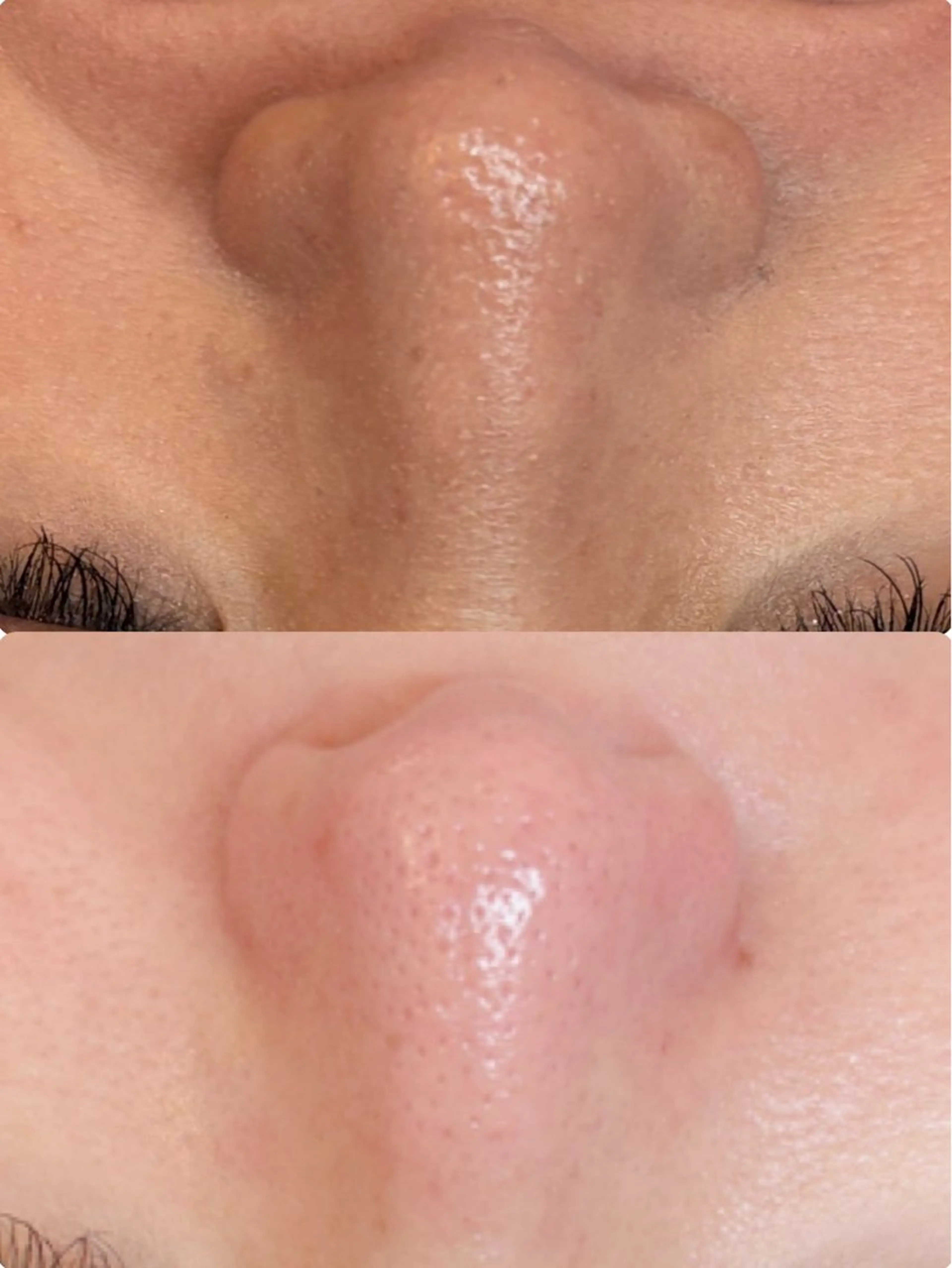 REMENTE池袋東口店所属・REMENTE🪞 KANAのエステ・リラクイメージ