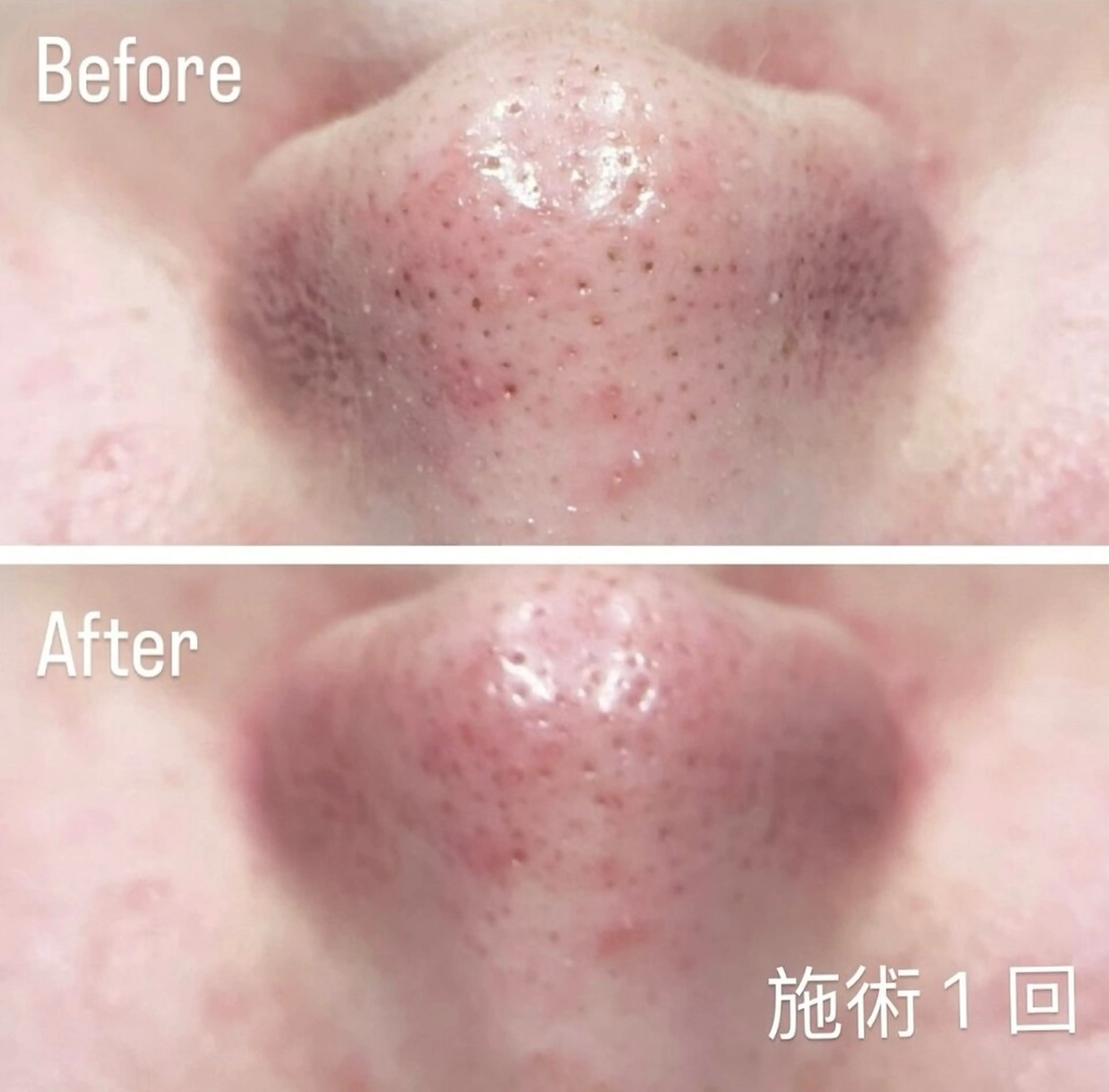 アンド ミルルのエステ・リラクイメージ