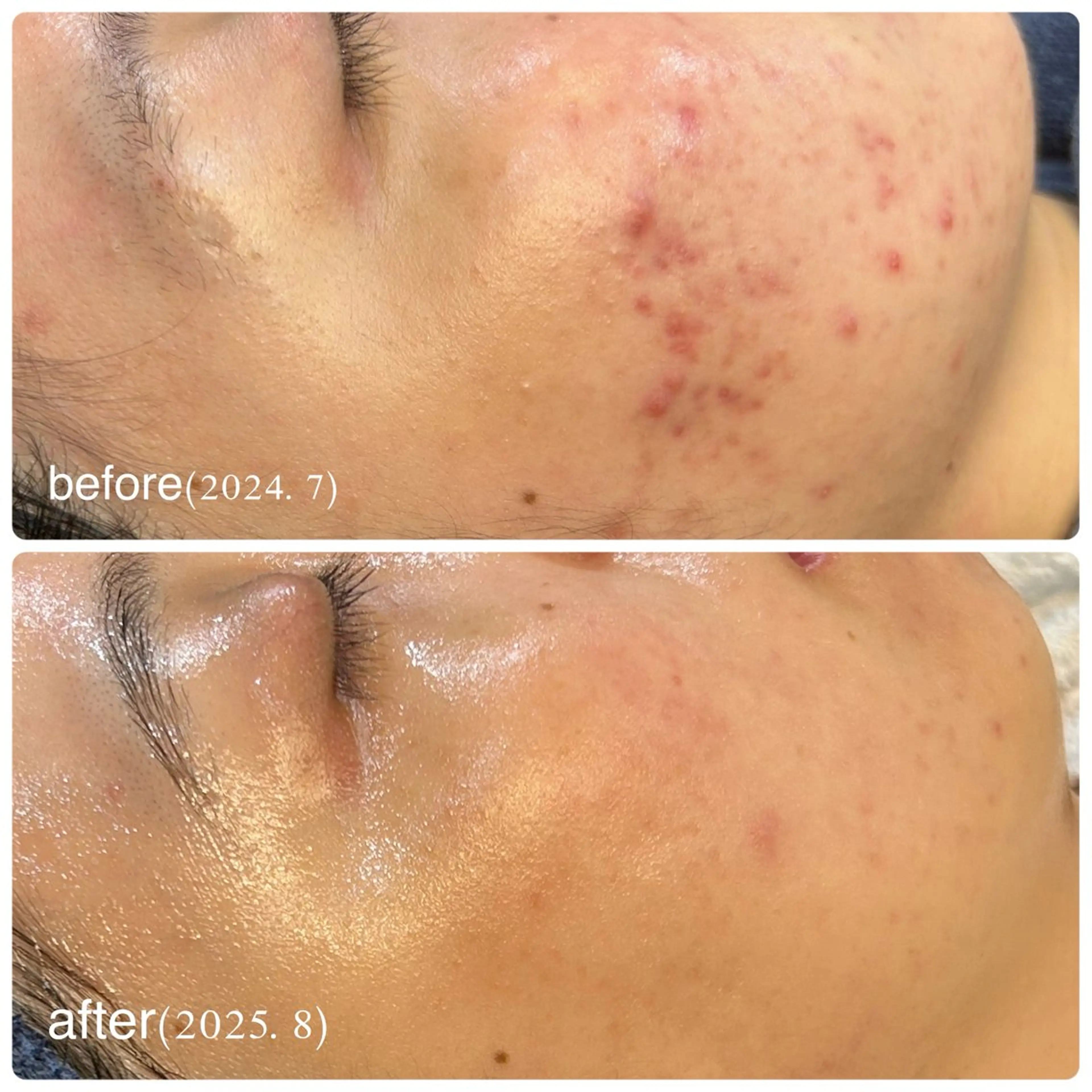 エステ leolo武蔵浦和 肌質改善＆脱毛のエステ・リラクイメージ