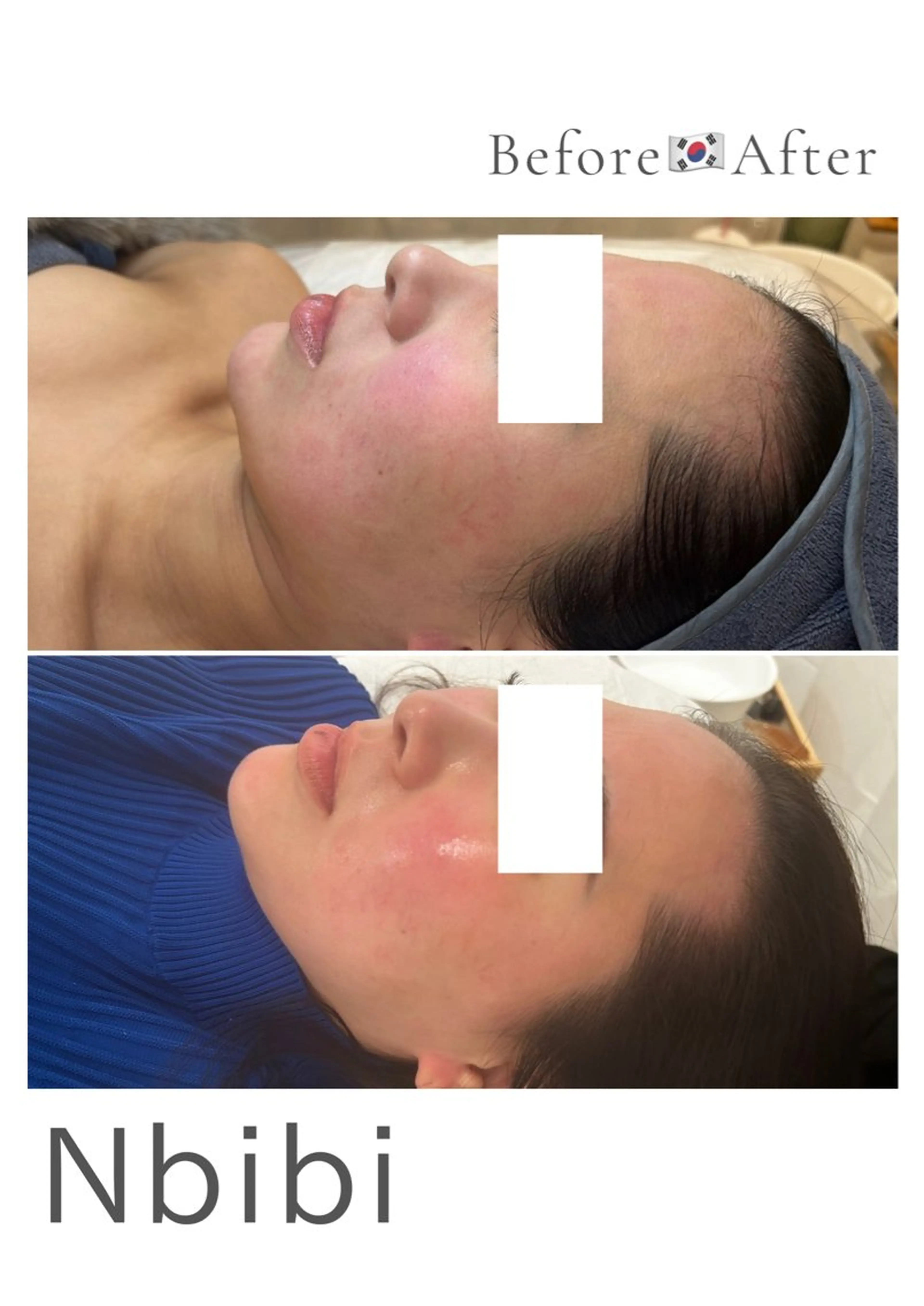 韓国🇰🇷価格 サロン_Nbibiのエステ・リラクイメージ