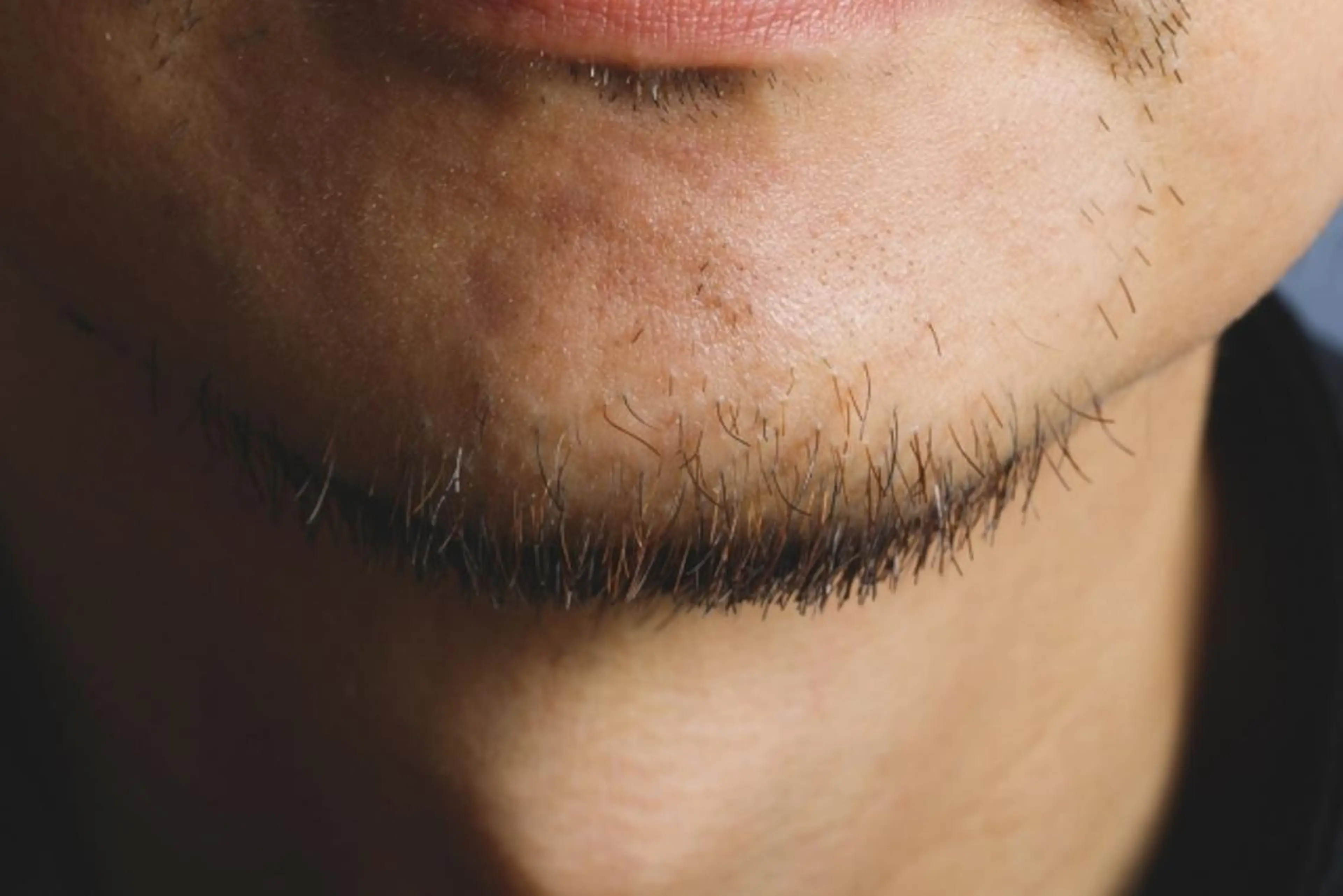 メンズ 脱毛 小顔・美肌ケア専門 Diva北浜のエステ・リラクイメージ