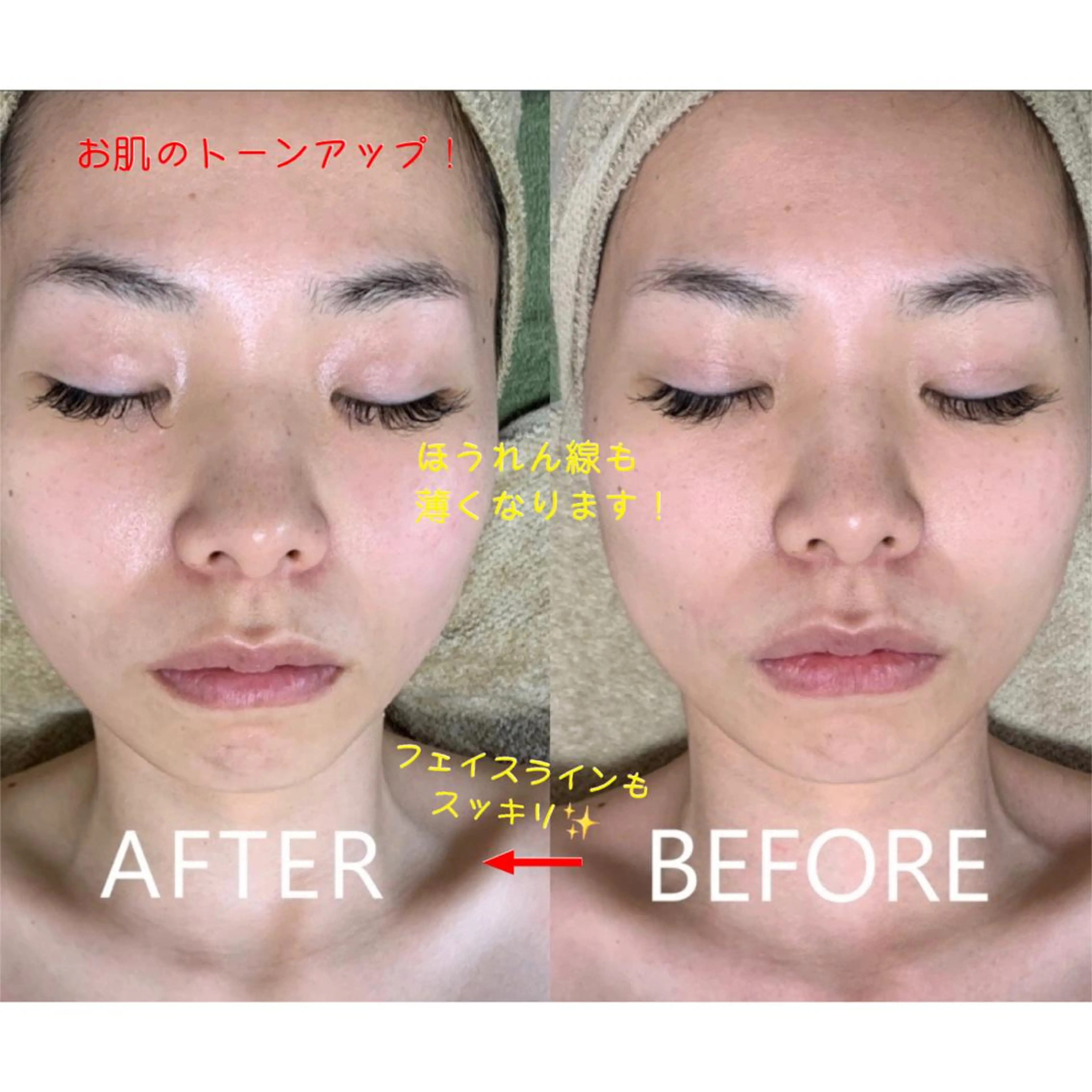 サロンur（ユア） Rieのエステ・リラクイメージ