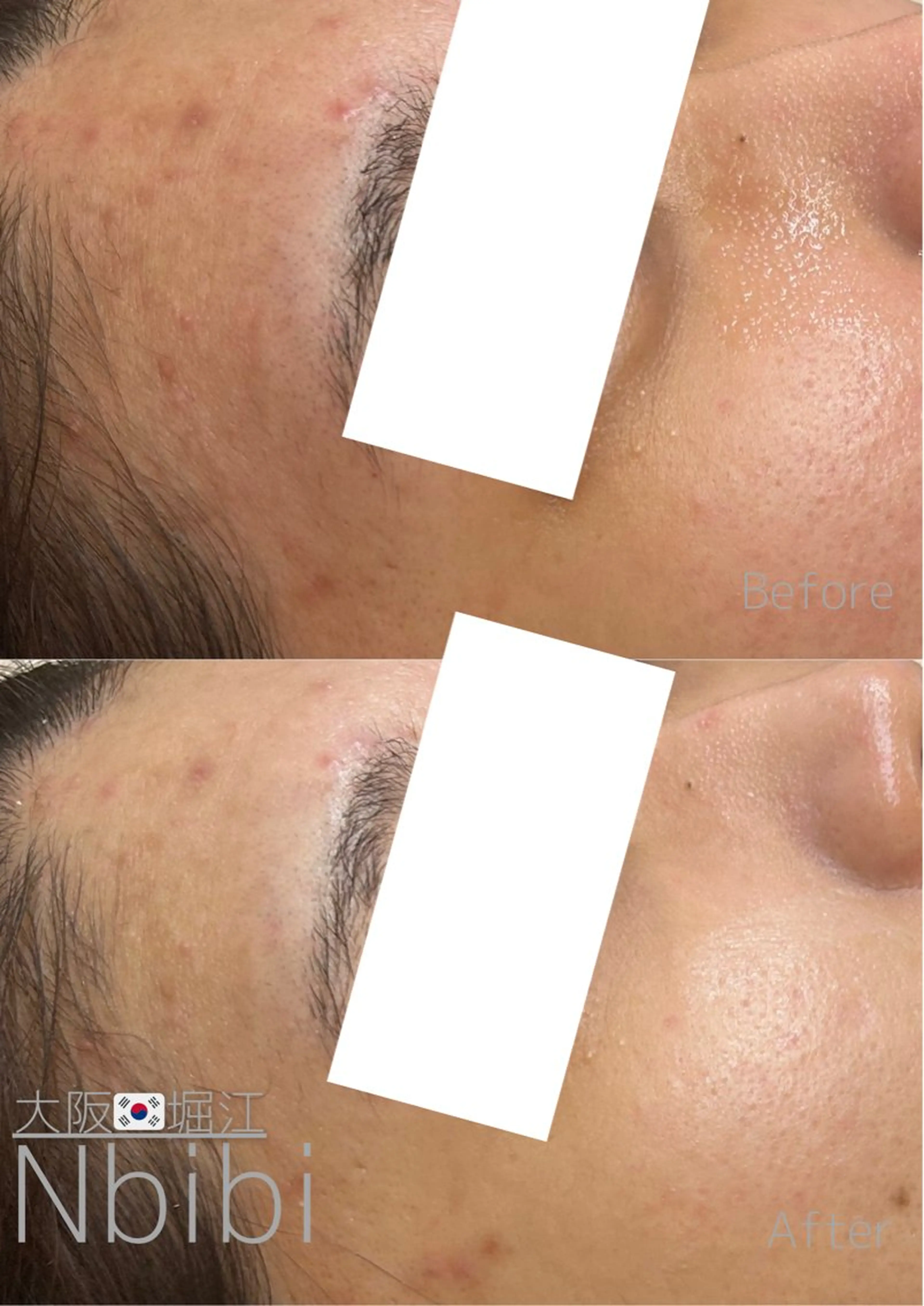 エステ 韓国🇰🇷価格 サロン_Nbibiのエステ・リラクイメージ